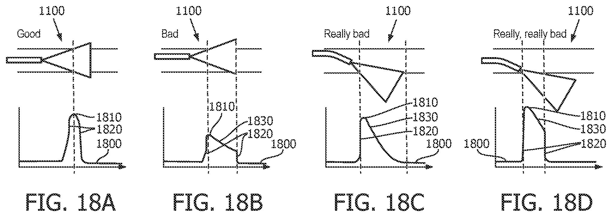 Patent US12496036 Figure 18 – Physiology sensing intraluminal device with positioning guidance and associated devices, systems, and methods