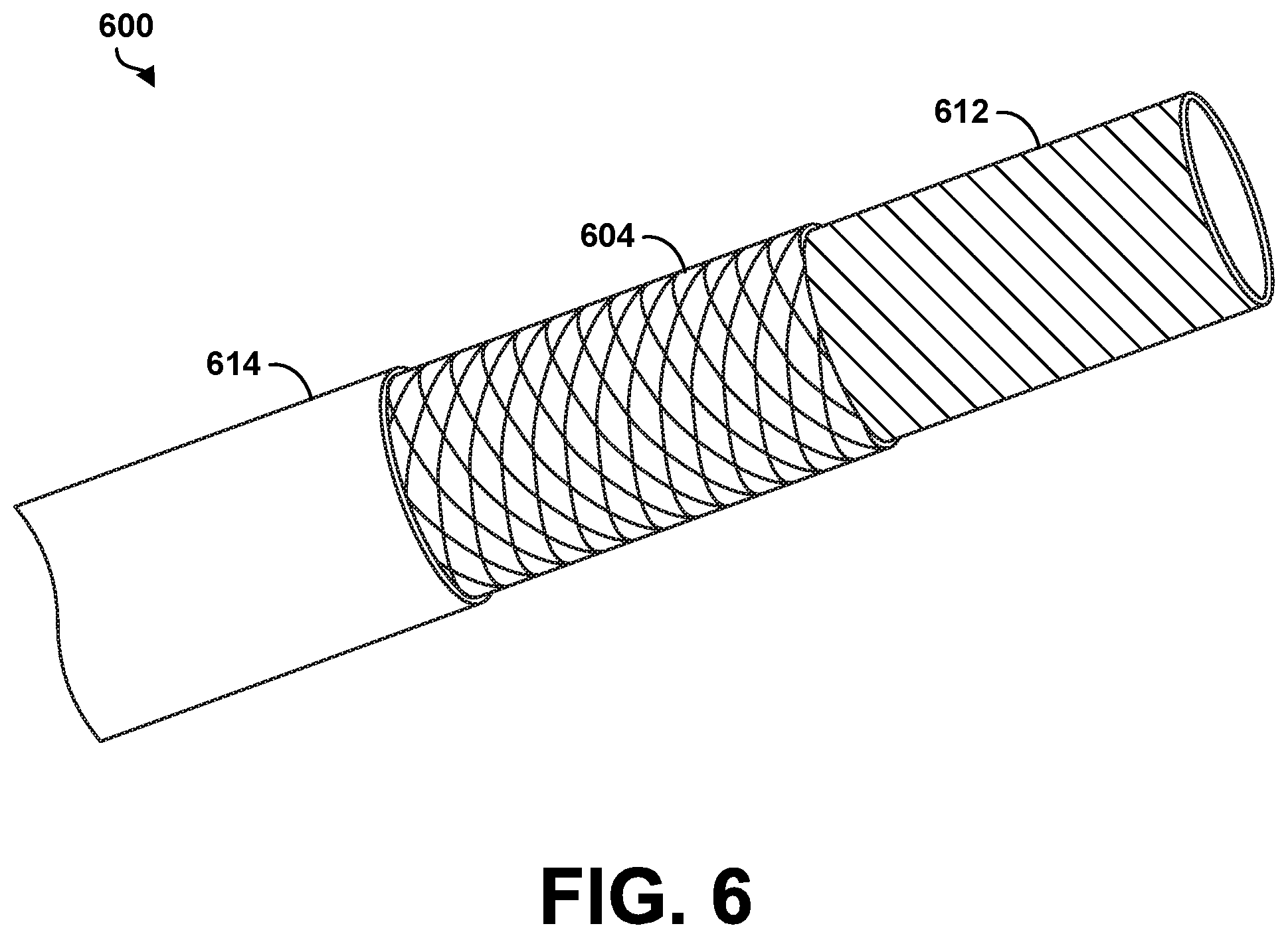 Patent US12496037 Figure 5 – Medical apparatus with enhanced ultrasound visibility