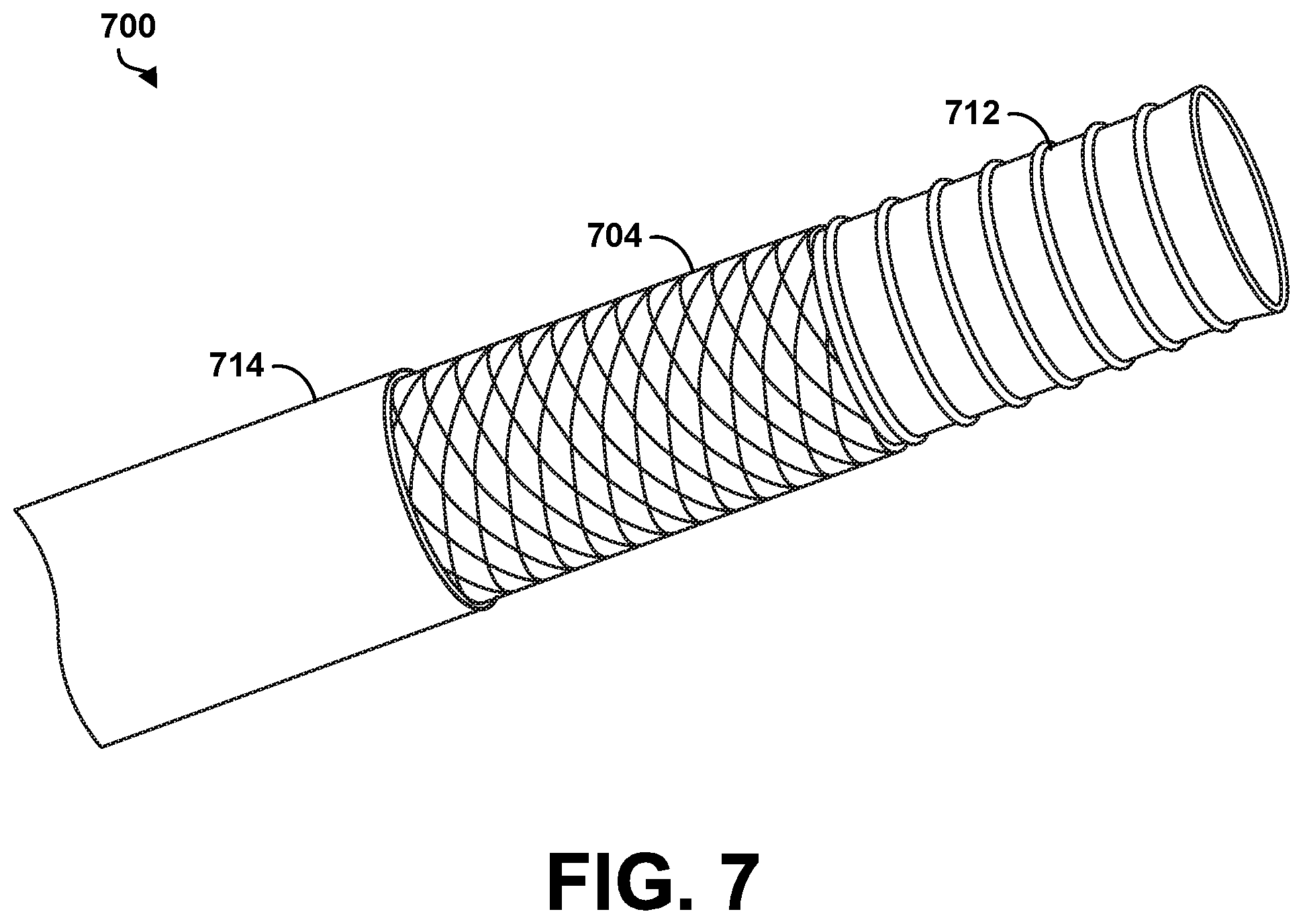 Patent US12496037 Figure 6 – Medical apparatus with enhanced ultrasound visibility