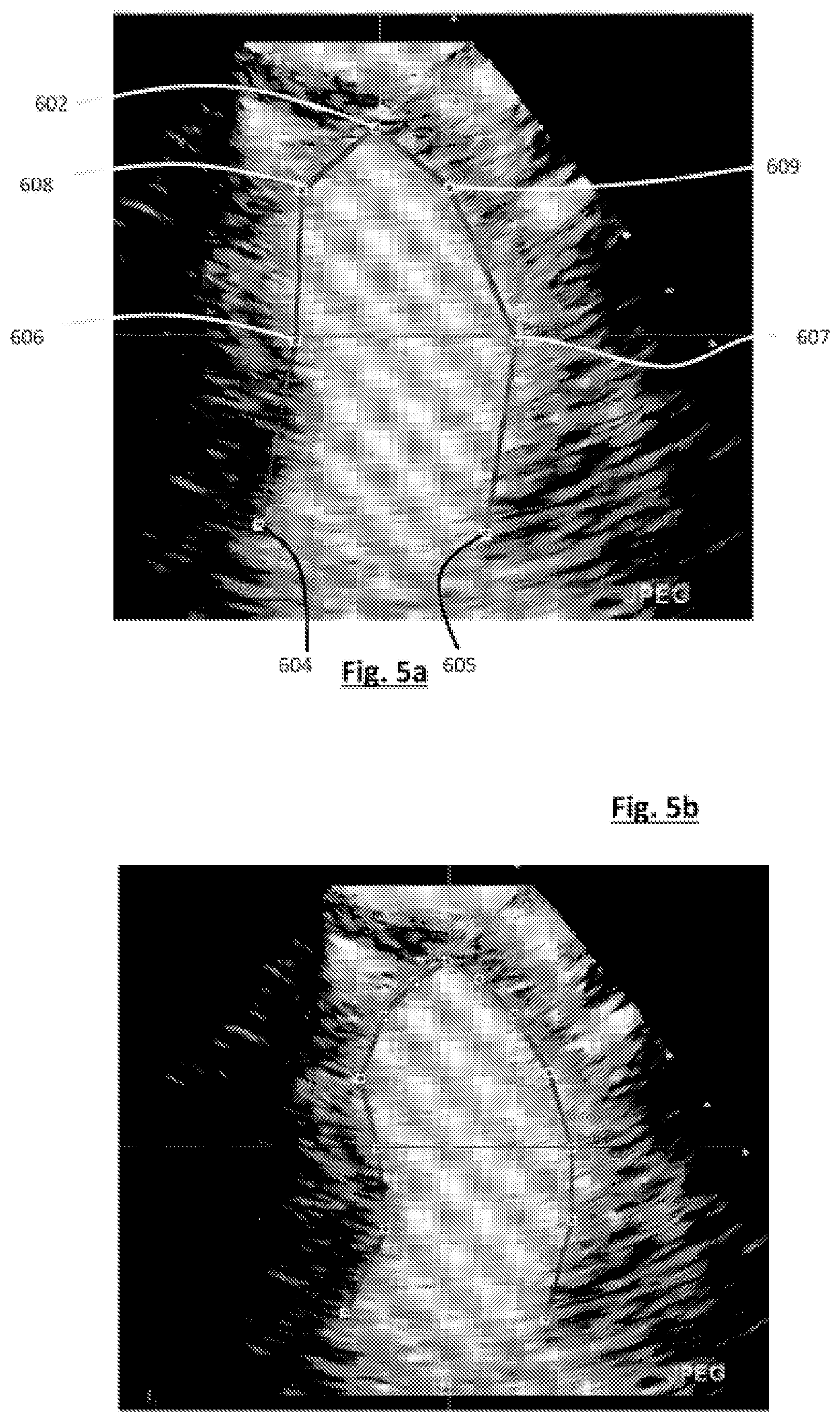 Patent US12496038 Figure 3 – Image-based diagnostic systems
