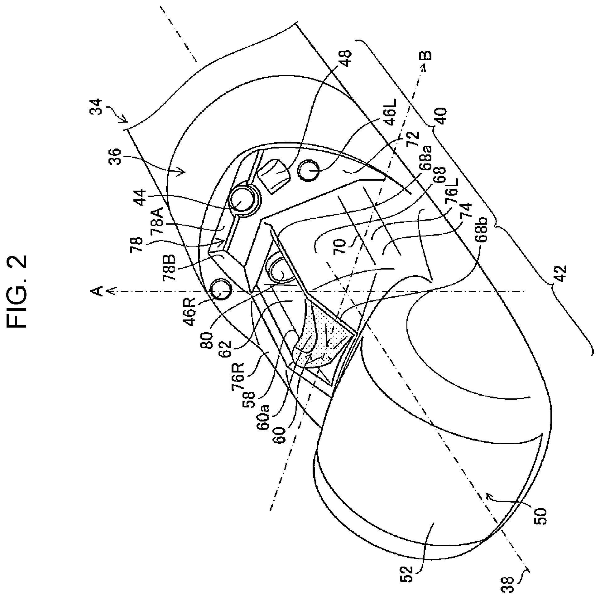 Patent US12496039 Figure 2 – Ultrasonic endoscope