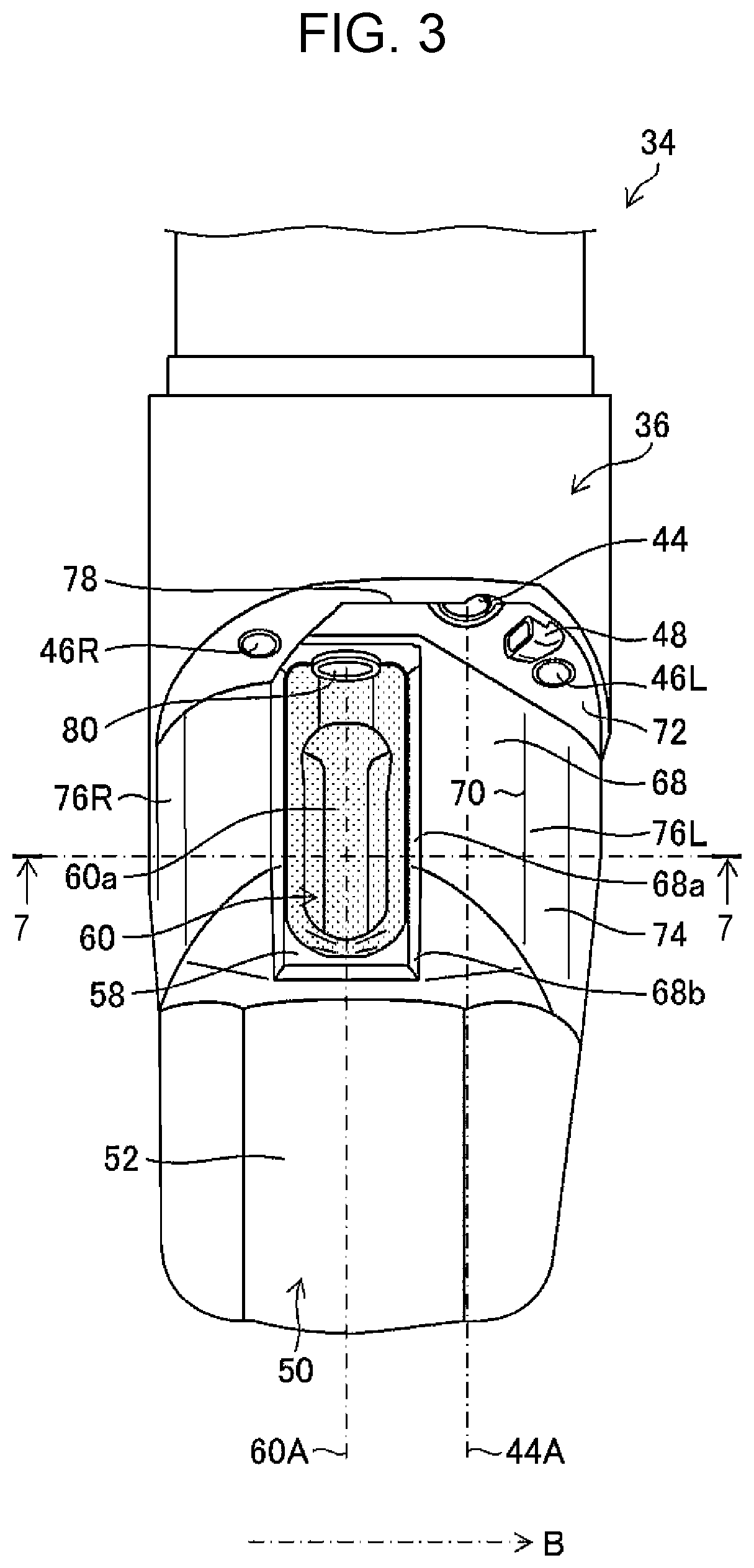 Patent US12496039 Figure 3 – Ultrasonic endoscope