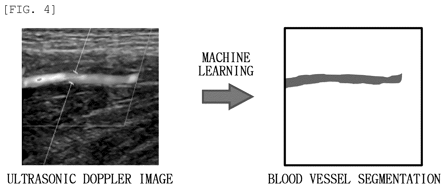 Patent US12496040 Figure 4 – Diagnosis system using attachable patch type ultrasonic transducer