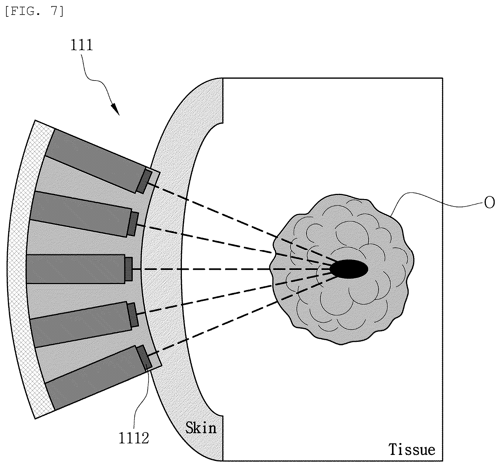 Patent US12496040 Figure 7 – Diagnosis system using attachable patch type ultrasonic transducer