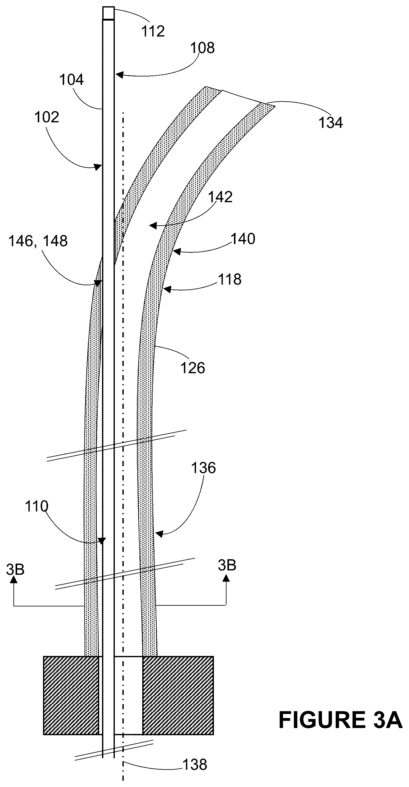 Patent US12496041 Figure 3 – Medical device assembly and related methods