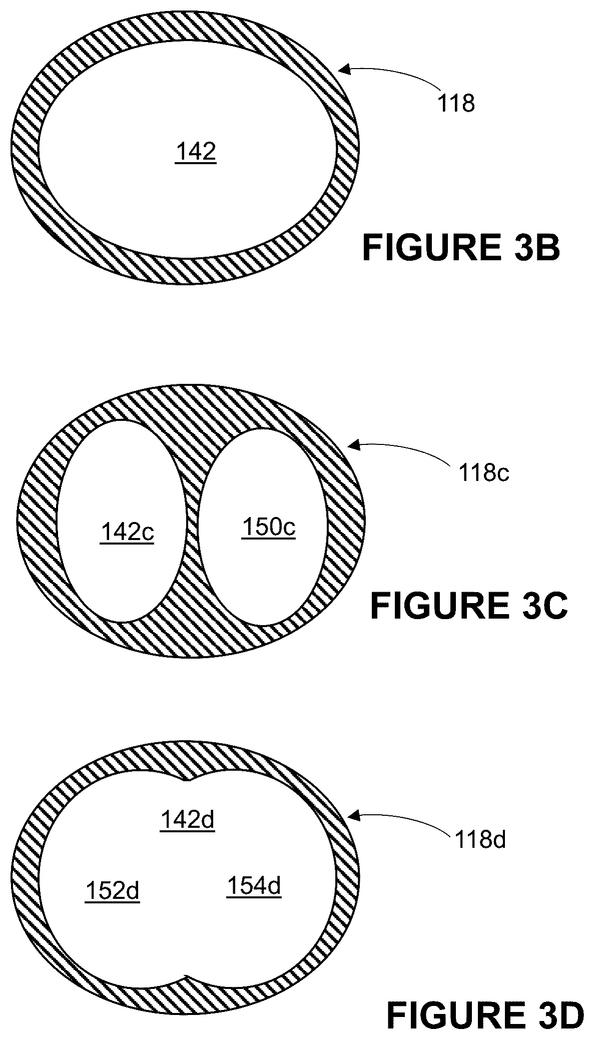 Patent US12496041 Figure 4 – Medical device assembly and related methods