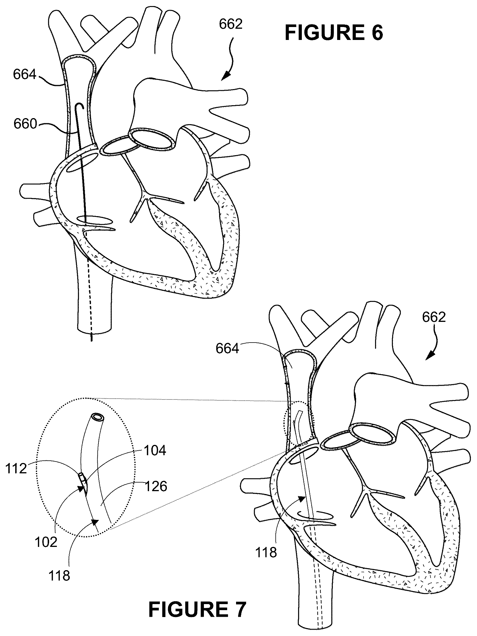 Patent US12496041 Figure 7 – Medical device assembly and related methods
