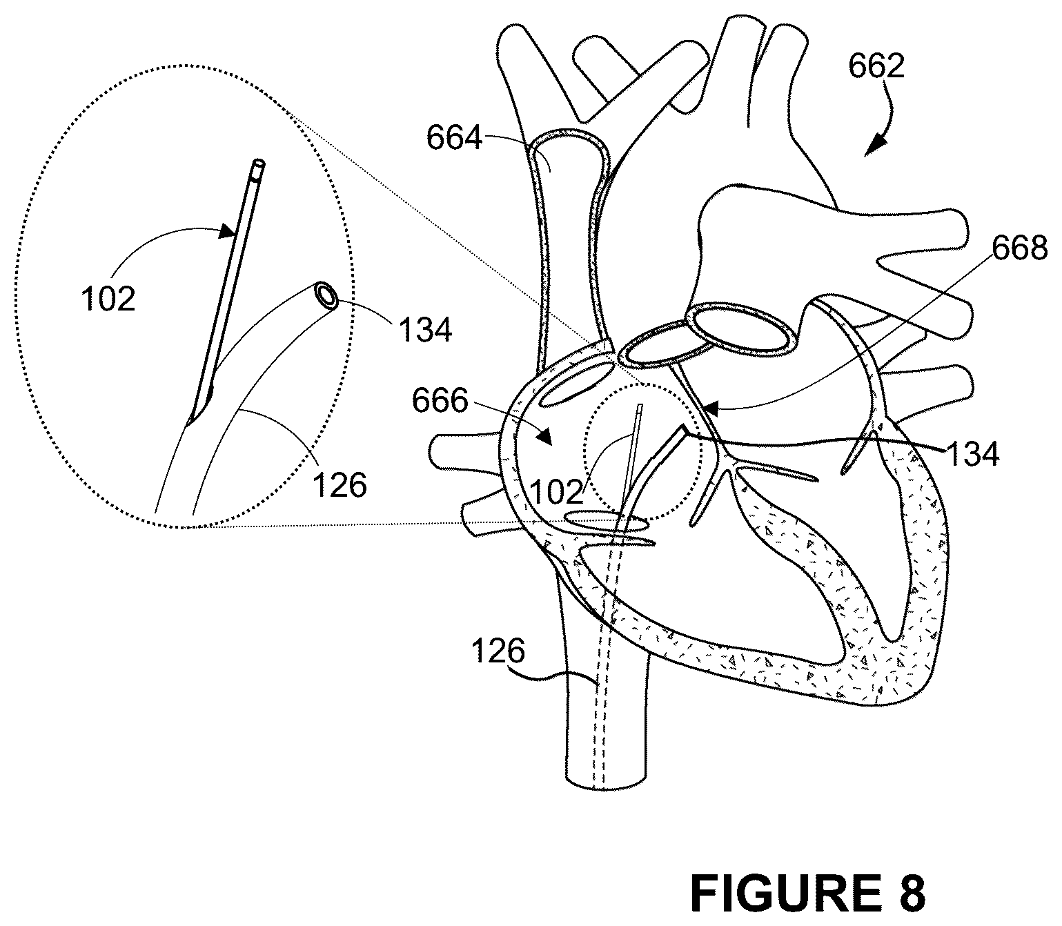 Patent US12496041 Figure 8 – Medical device assembly and related methods