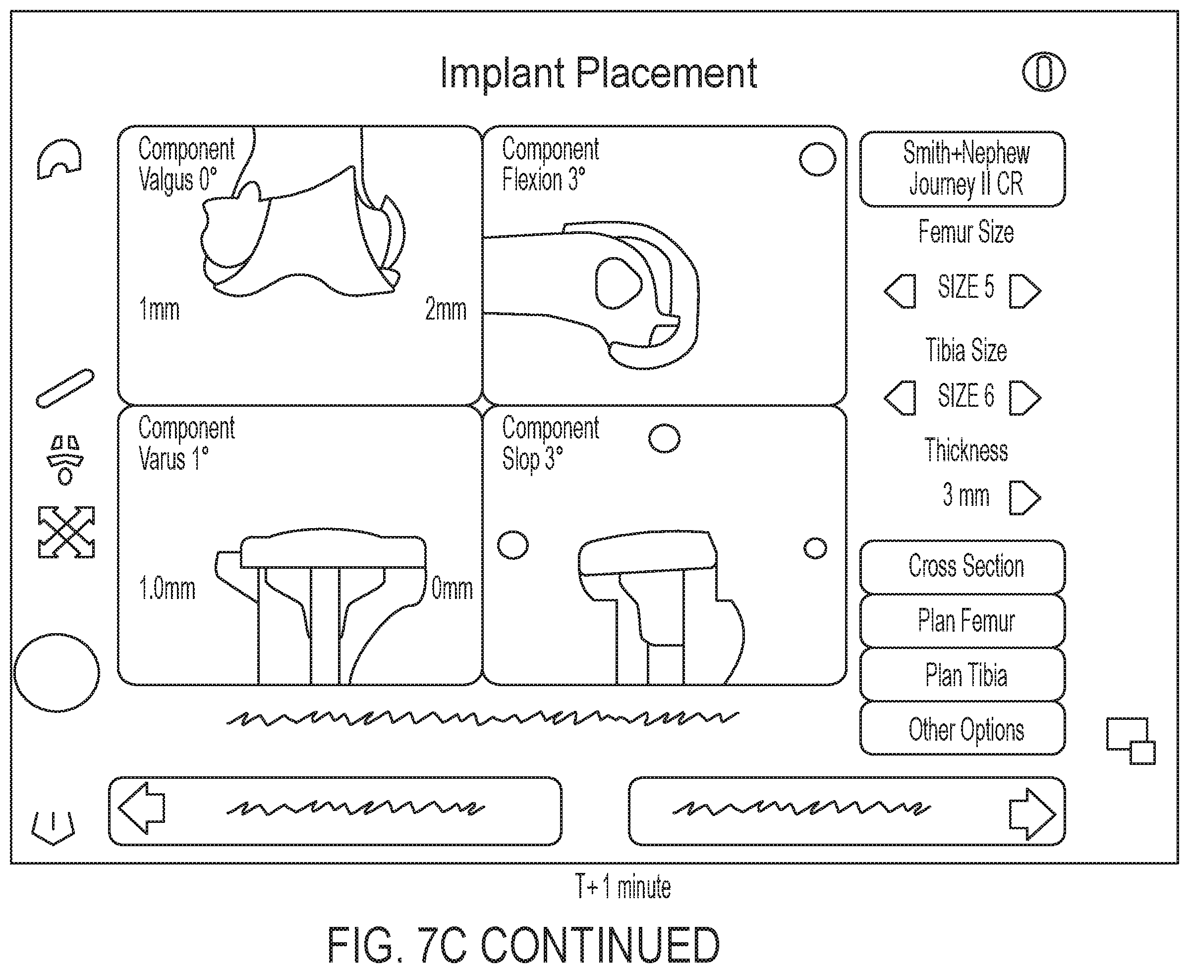 Patent US12496043 Figure 12 – Methods for improved ultrasound imaging to emphasize structures of interest and devices thereof