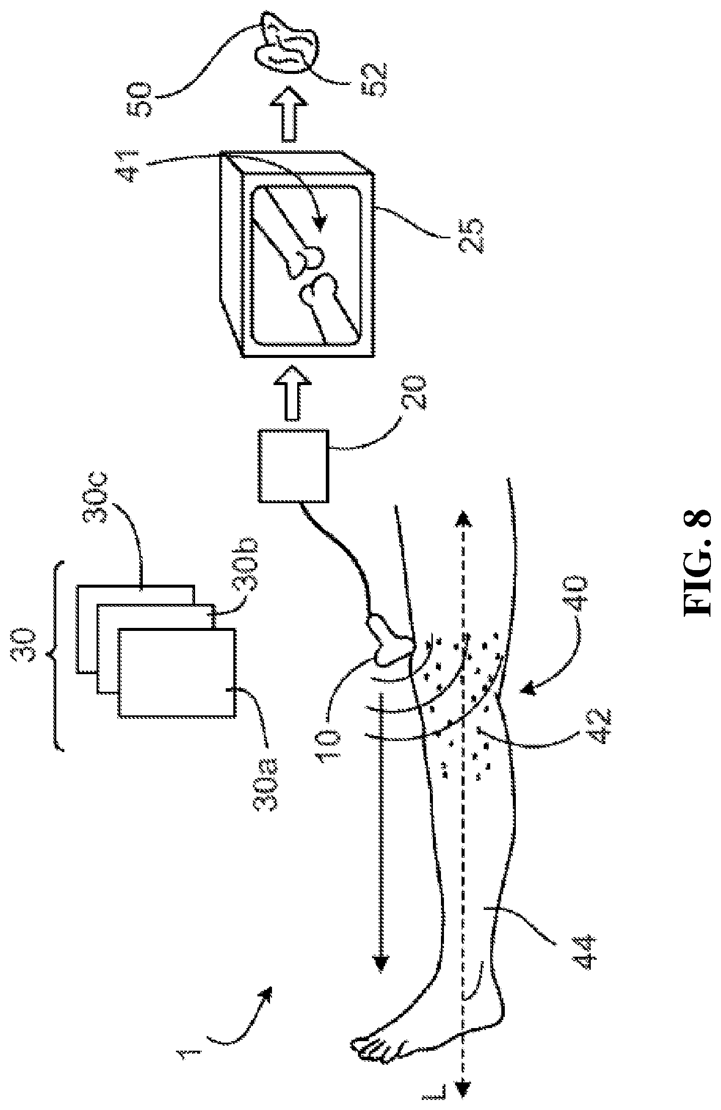 Patent US12496043 Figure 14 – Methods for improved ultrasound imaging to emphasize structures of interest and devices thereof