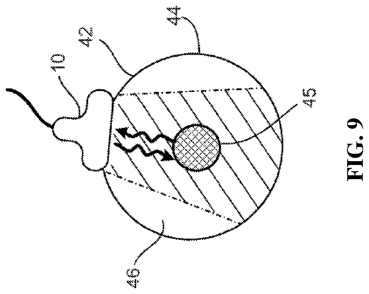 Patent US12496043 Figure 15 – Methods for improved ultrasound imaging to emphasize structures of interest and devices thereof