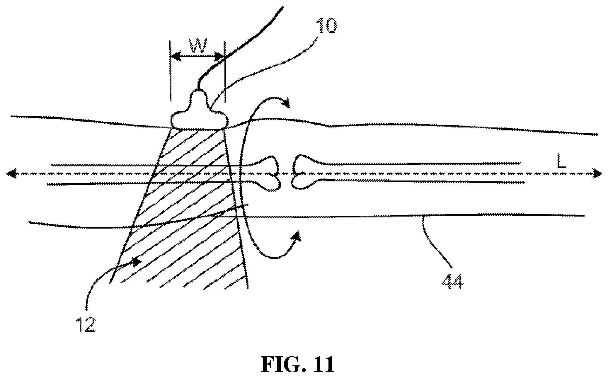 Patent US12496043 Figure 17 – Methods for improved ultrasound imaging to emphasize structures of interest and devices thereof