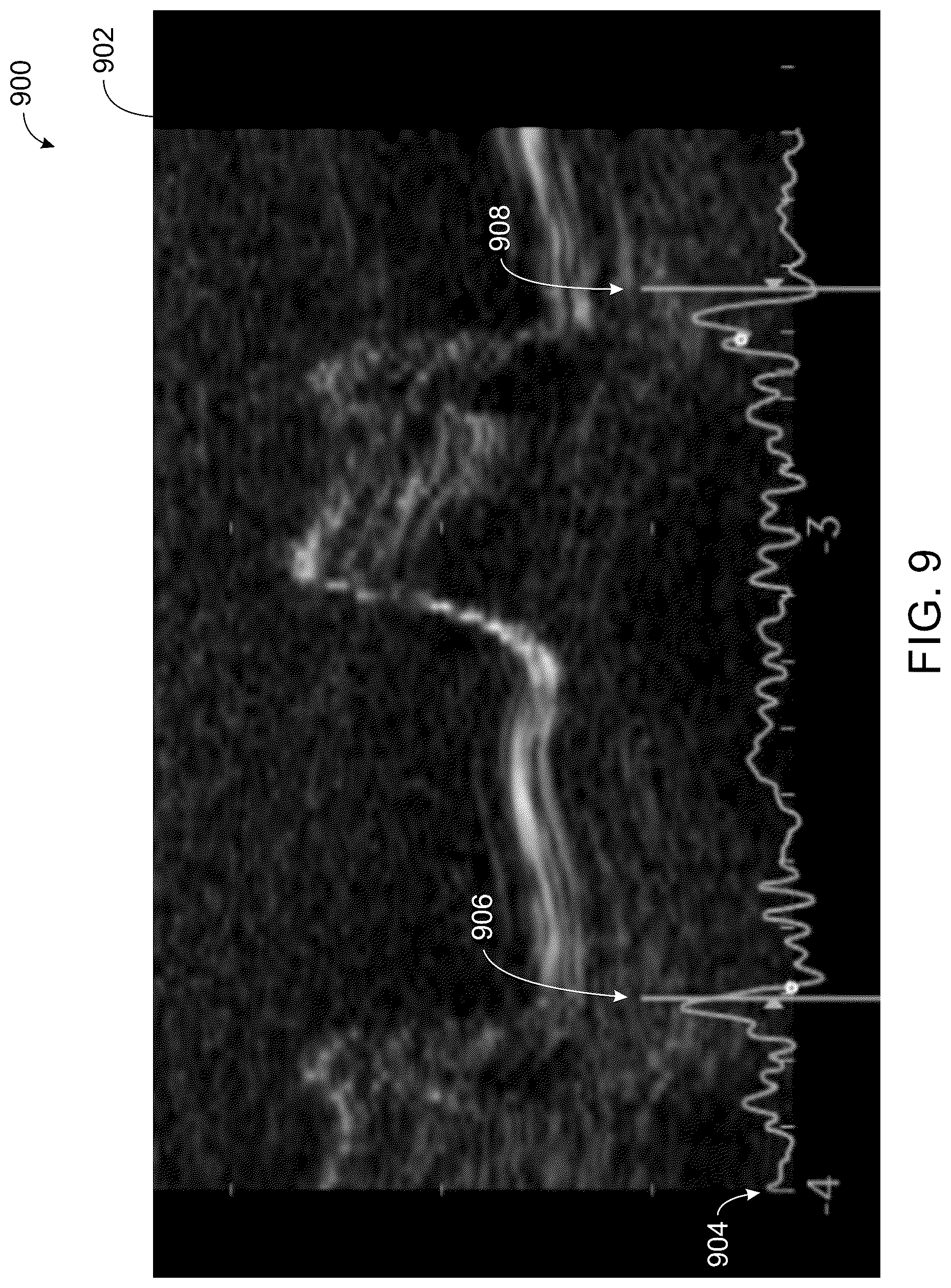 Patent US12496044 Figure 9 – System and method for real-time correction of strain traces in patients with conduction delays