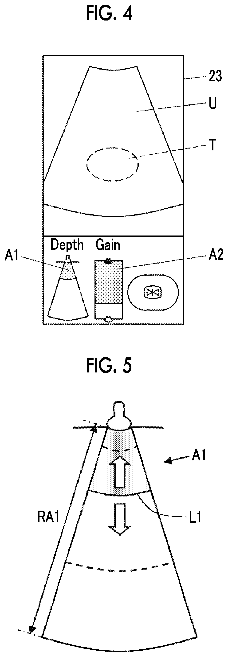 Patent US12496045 Figure 3 – Ultrasound diagnostic apparatus and control method of ultrasound diagnostic apparatus