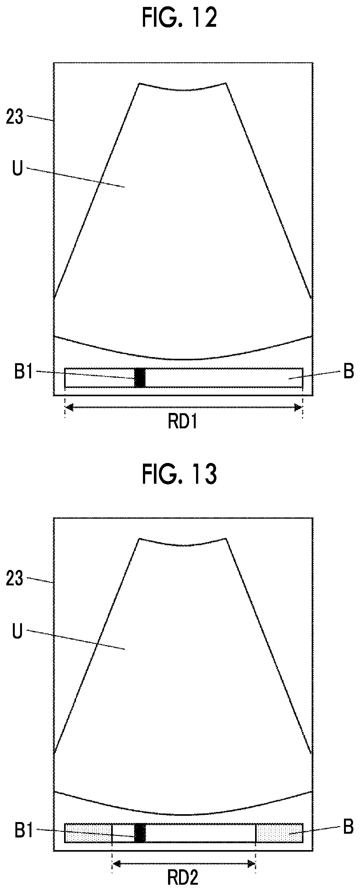Patent US12496045 Figure 7 – Ultrasound diagnostic apparatus and control method of ultrasound diagnostic apparatus