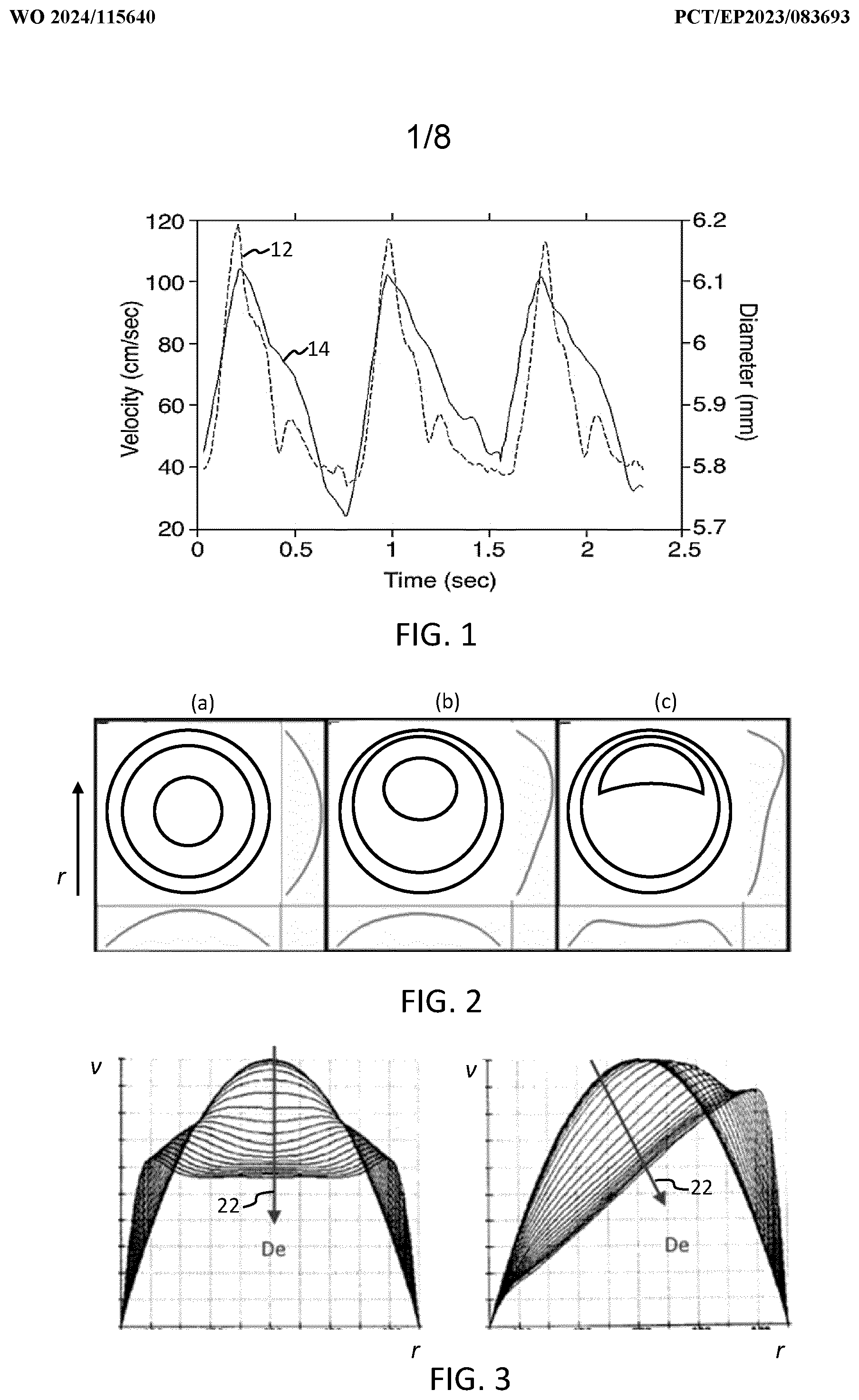 Patent US12496046 Figure 1 – Hemodynamic parameter estimation