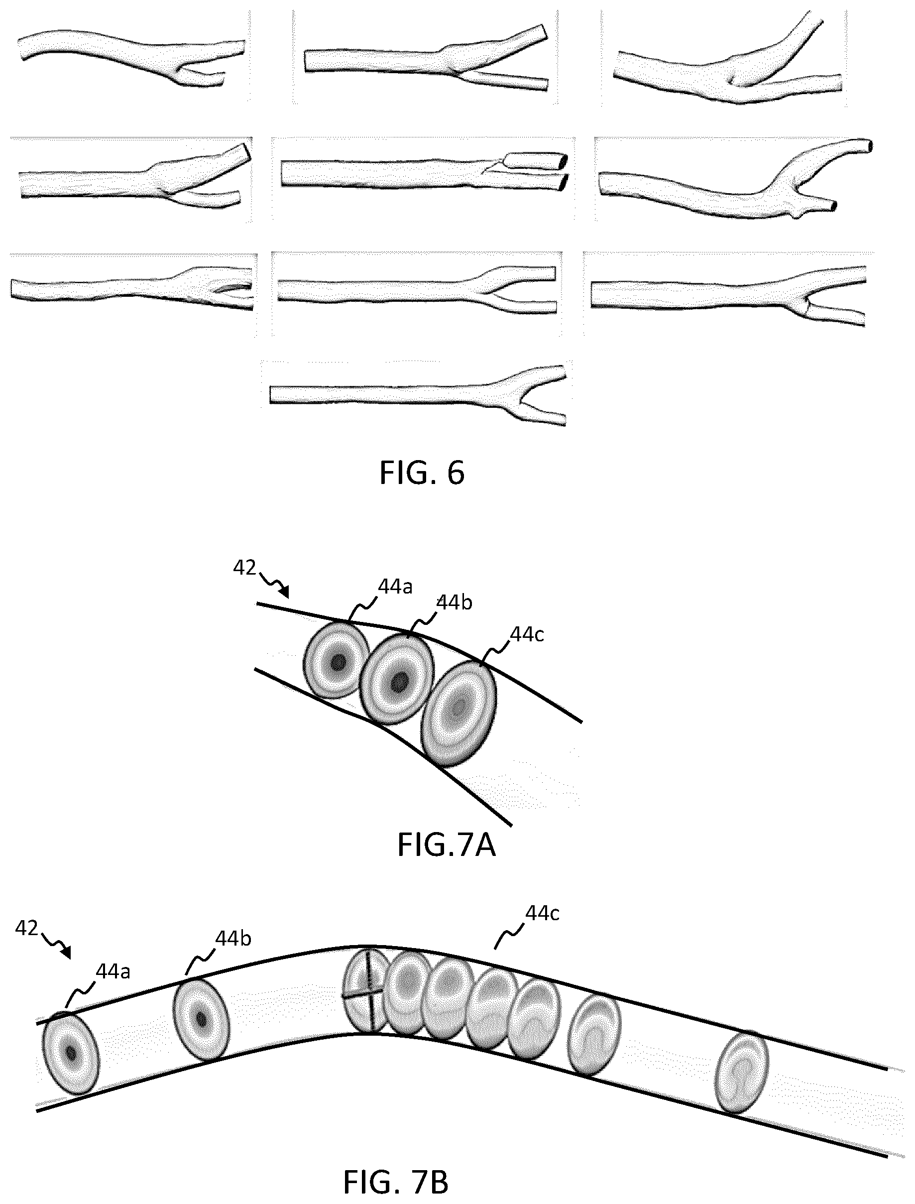 Patent US12496046 Figure 3 – Hemodynamic parameter estimation