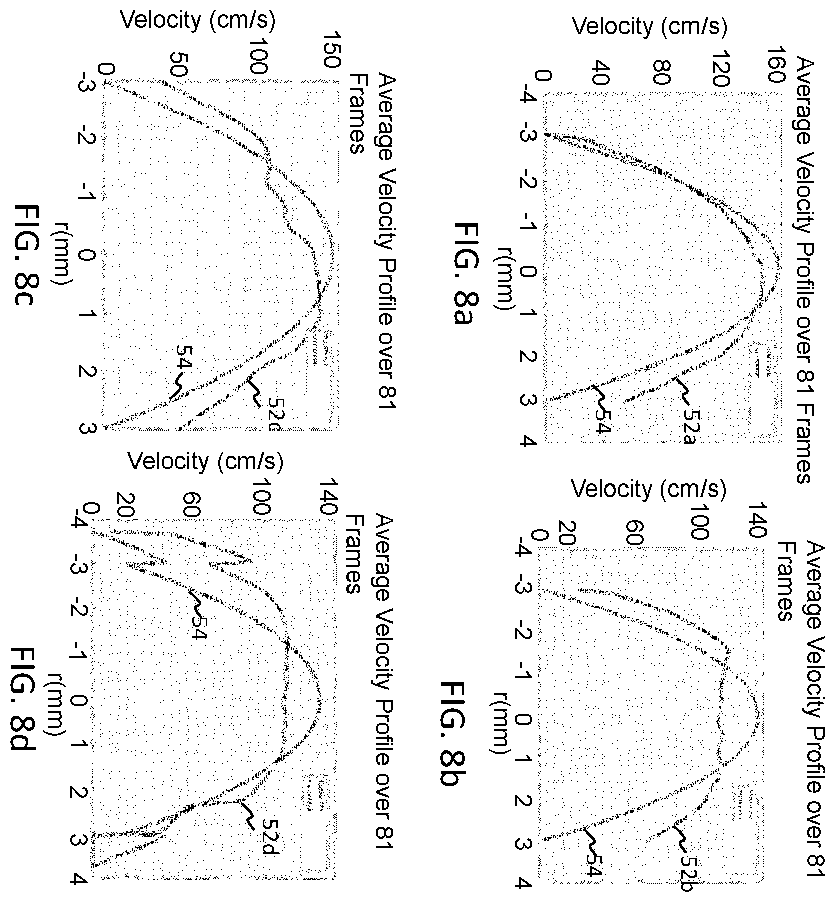 Patent US12496046 Figure 4 – Hemodynamic parameter estimation
