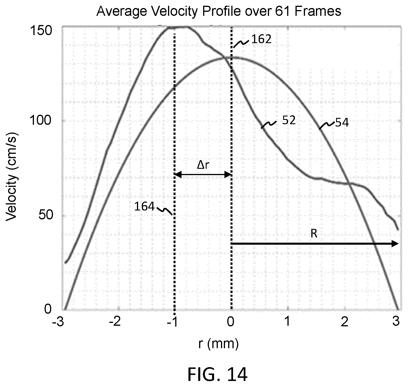 Patent US12496046 Figure 7 – Hemodynamic parameter estimation