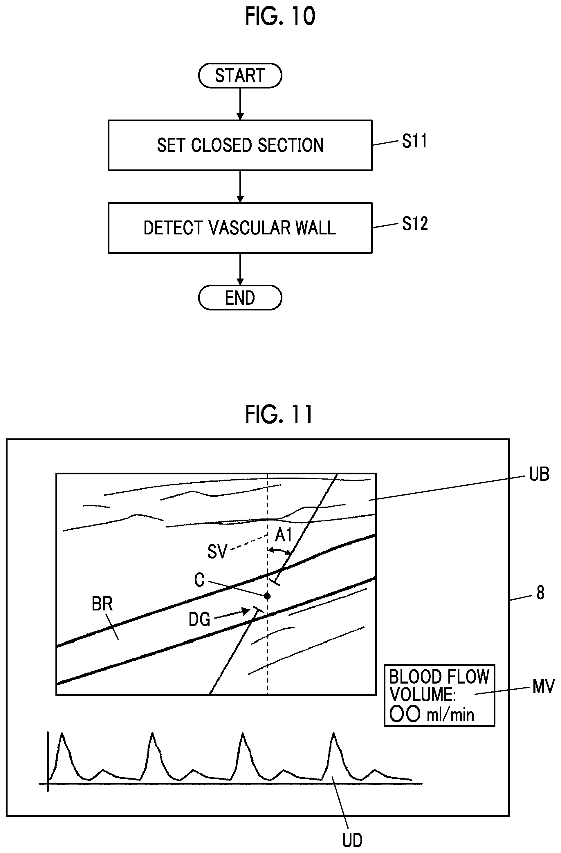 Patent US12496047 Figure 7 – Ultrasound diagnostic apparatus and control method of ultrasound diagnostic apparatus