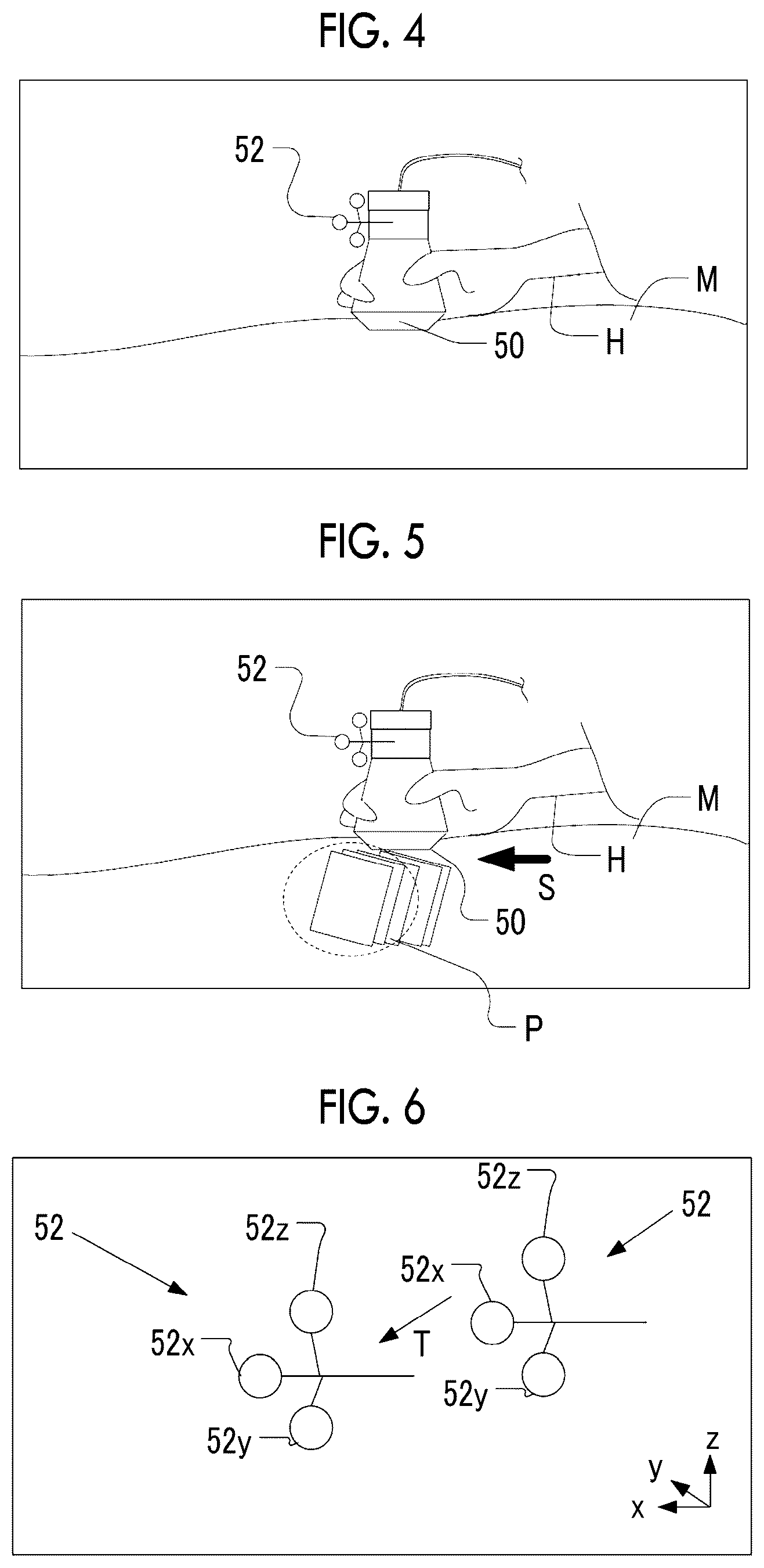 Patent US12496048 Figure 3 – Three-dimensional ultrasound imaging support apparatus, three-dimensional ultrasound imaging support method, and three-dimensional ultrasound imaging support program