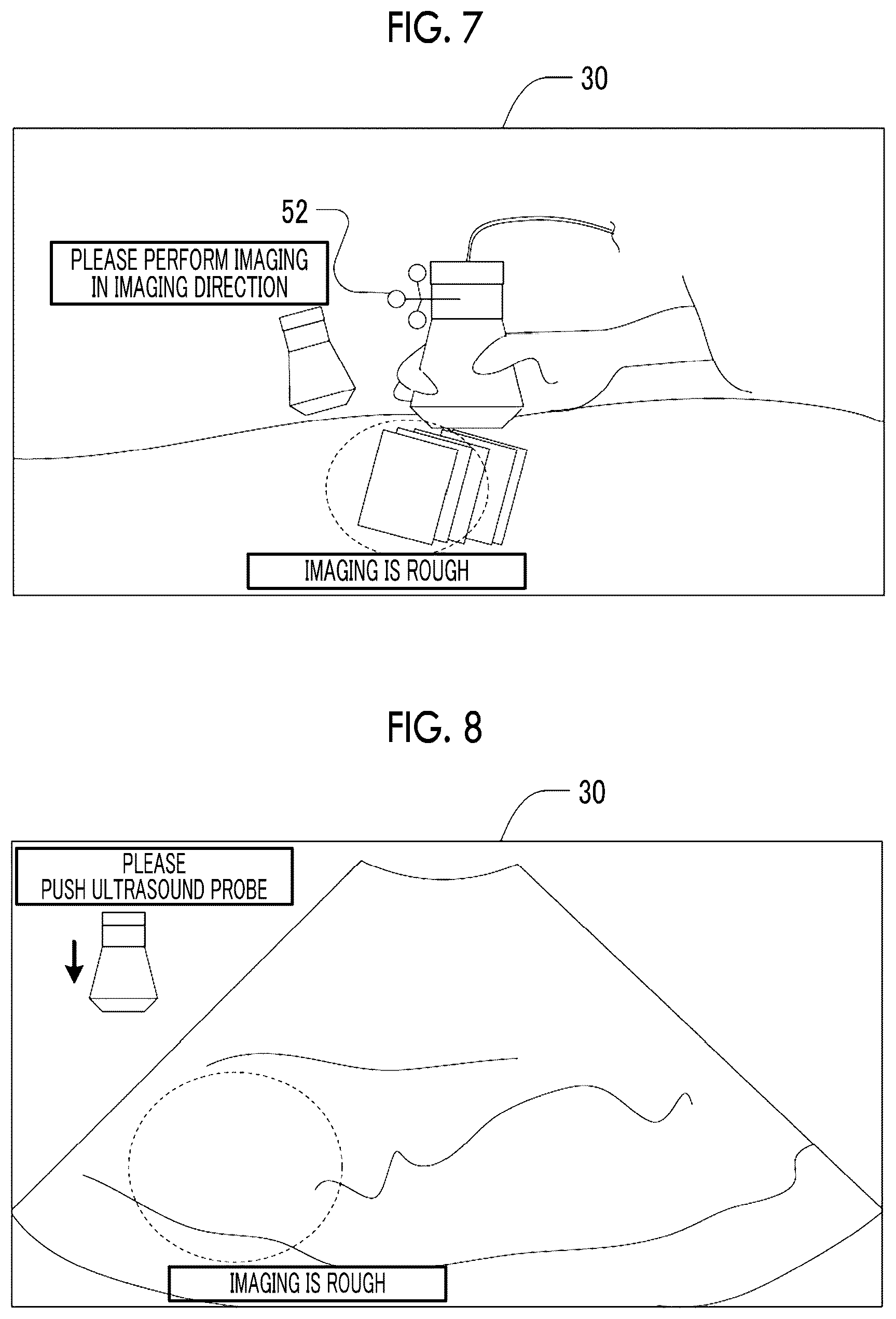 Patent US12496048 Figure 4 – Three-dimensional ultrasound imaging support apparatus, three-dimensional ultrasound imaging support method, and three-dimensional ultrasound imaging support program