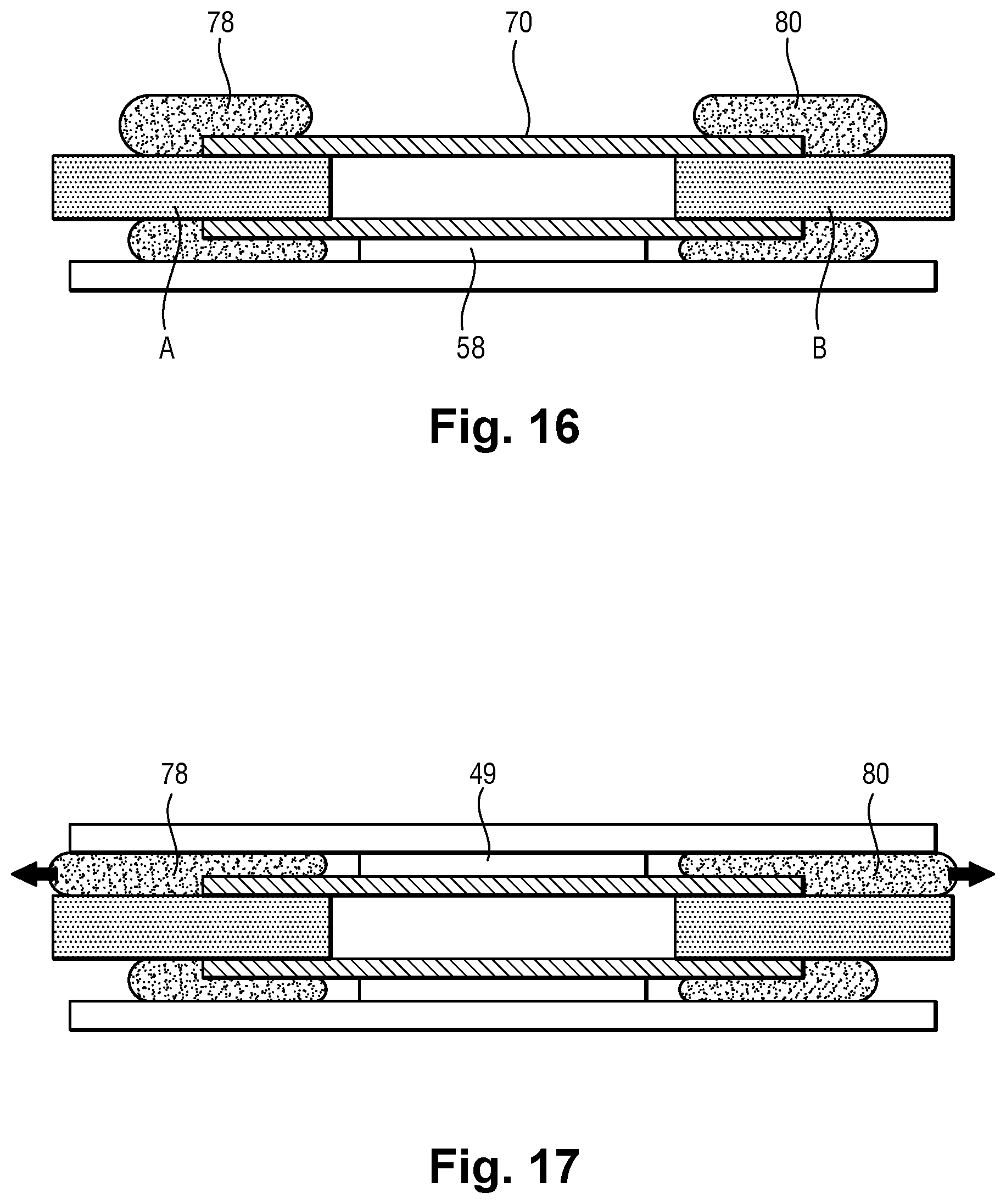 Patent US12496051 Figure 13 – Device for applying adhesive composition to biological tissue and/or prosthetic material