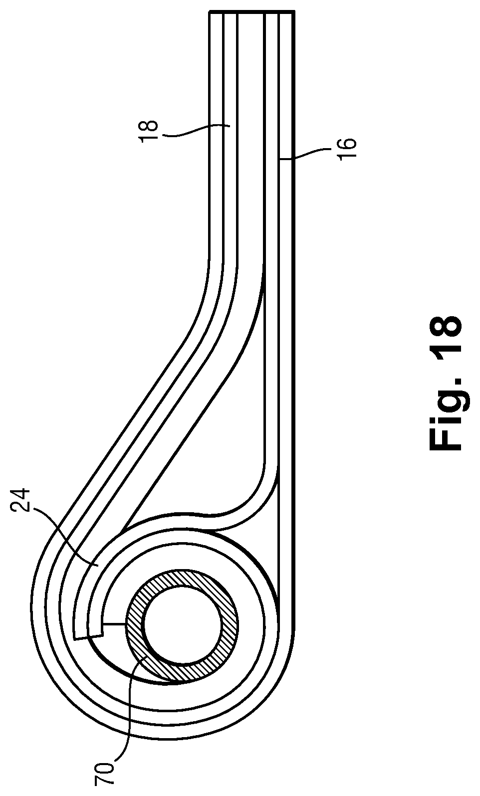 Patent US12496051 Figure 14 – Device for applying adhesive composition to biological tissue and/or prosthetic material