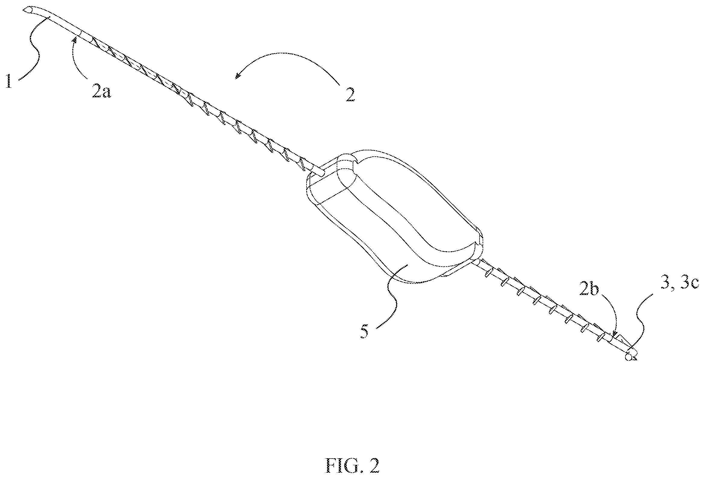 Patent US12496054 Figure 2 – Intracorporeal retracting suture