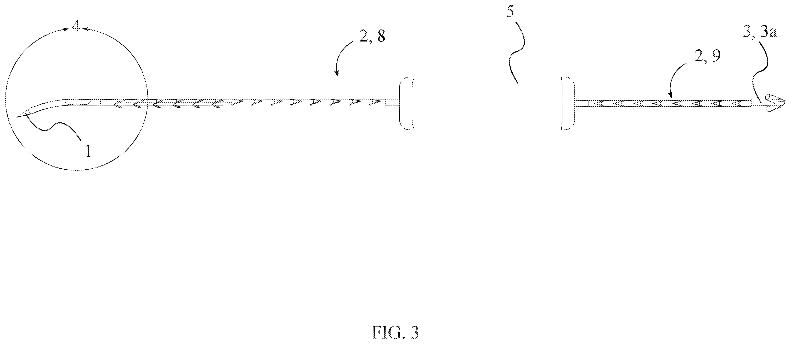 Patent US12496054 Figure 3 – Intracorporeal retracting suture