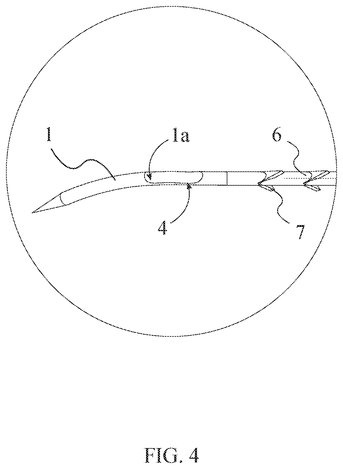 Patent US12496054 Figure 4 – Intracorporeal retracting suture