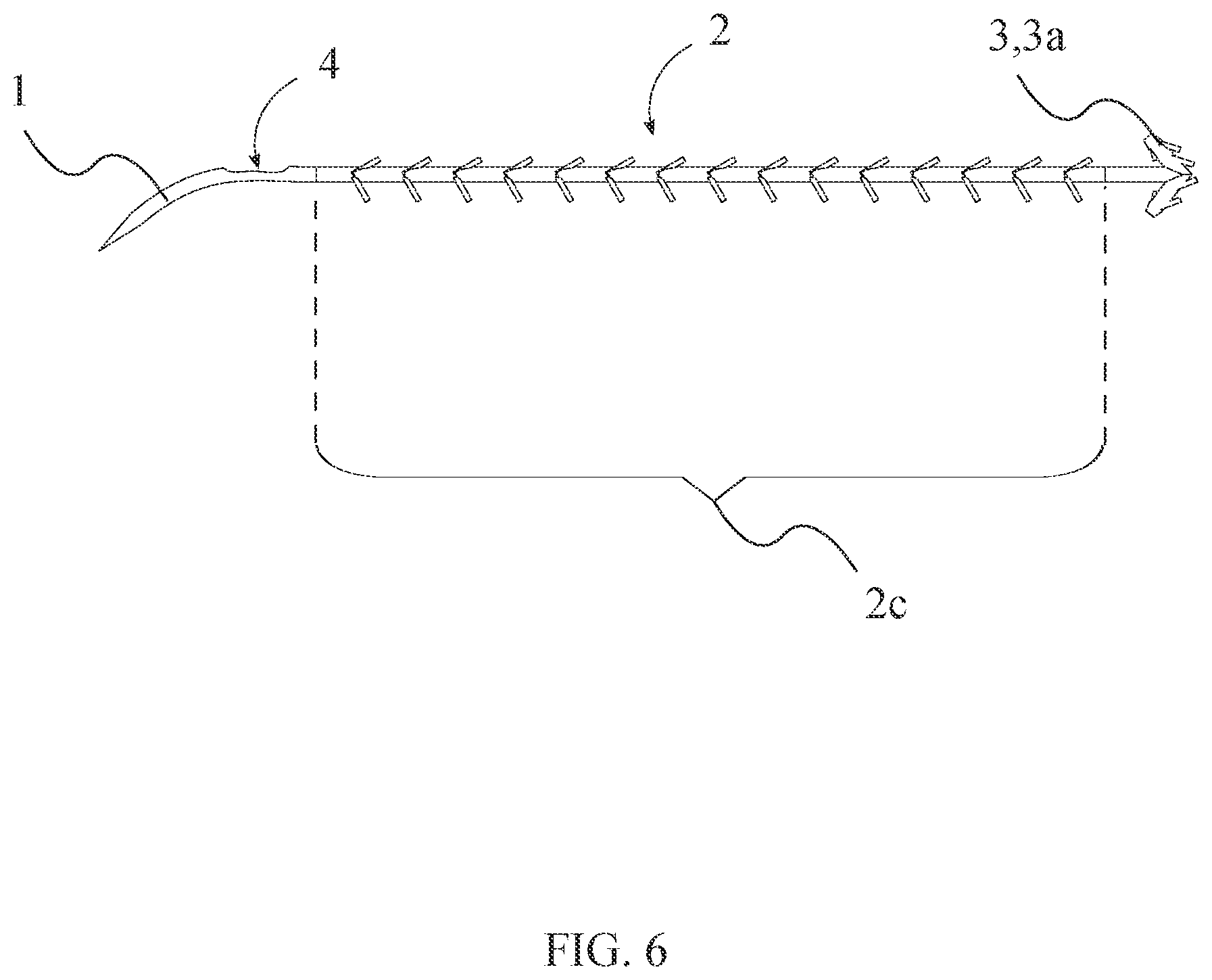 Patent US12496054 Figure 6 – Intracorporeal retracting suture