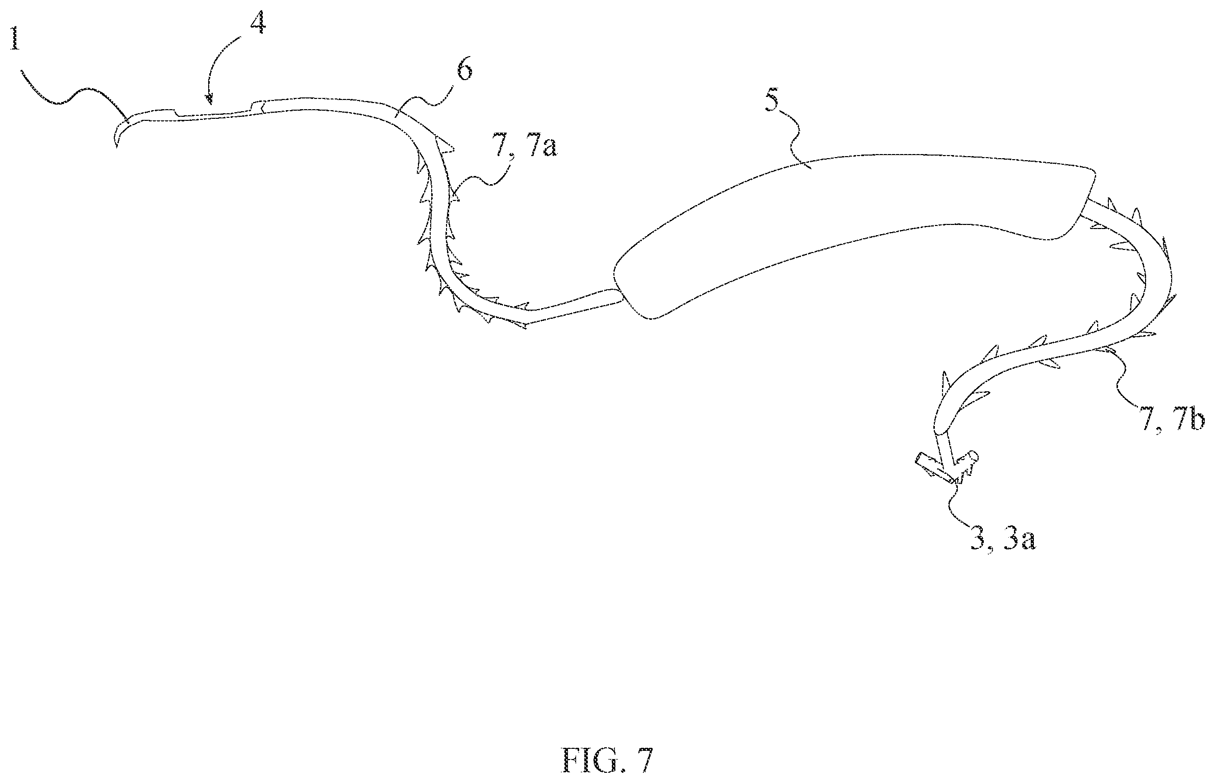 Patent US12496054 Figure 7 – Intracorporeal retracting suture