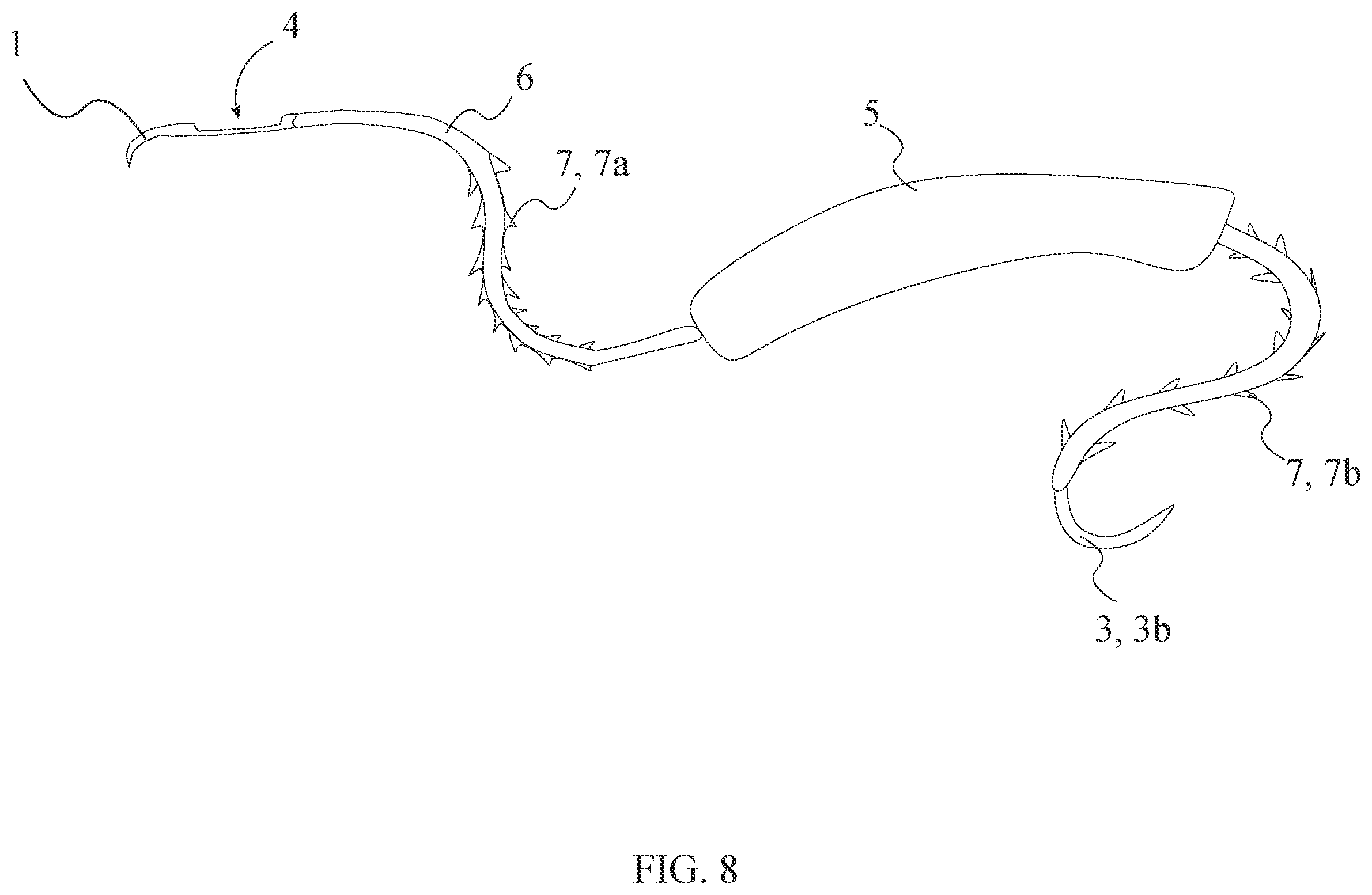 Patent US12496054 Figure 8 – Intracorporeal retracting suture