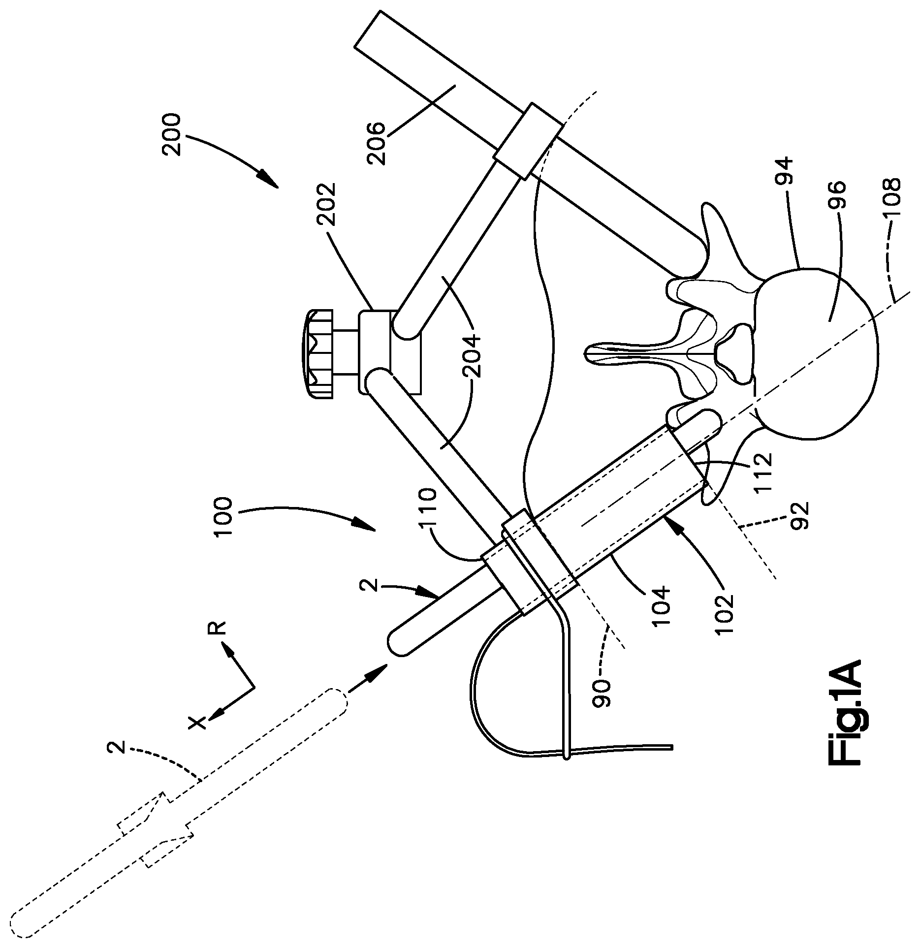 Patent US12496055 Figure 1 – Retractor members, and related systems and methods
