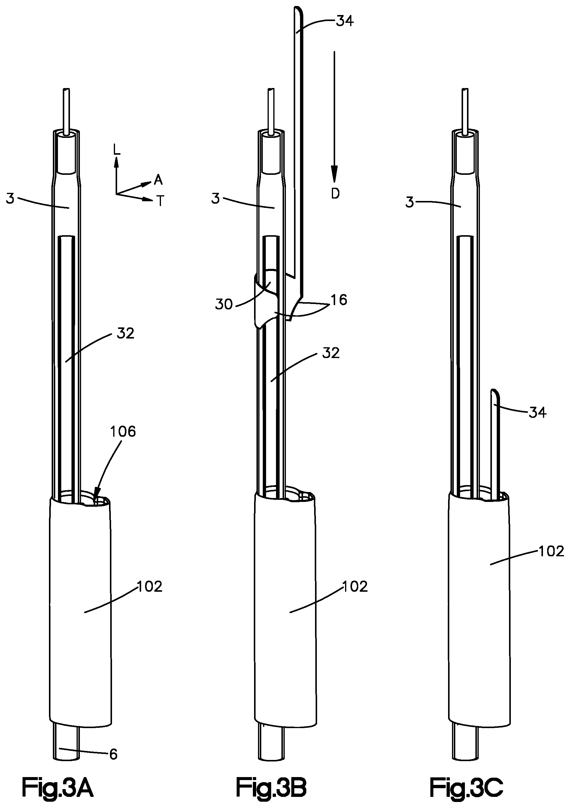 Patent US12496055 Figure 5 – Retractor members, and related systems and methods