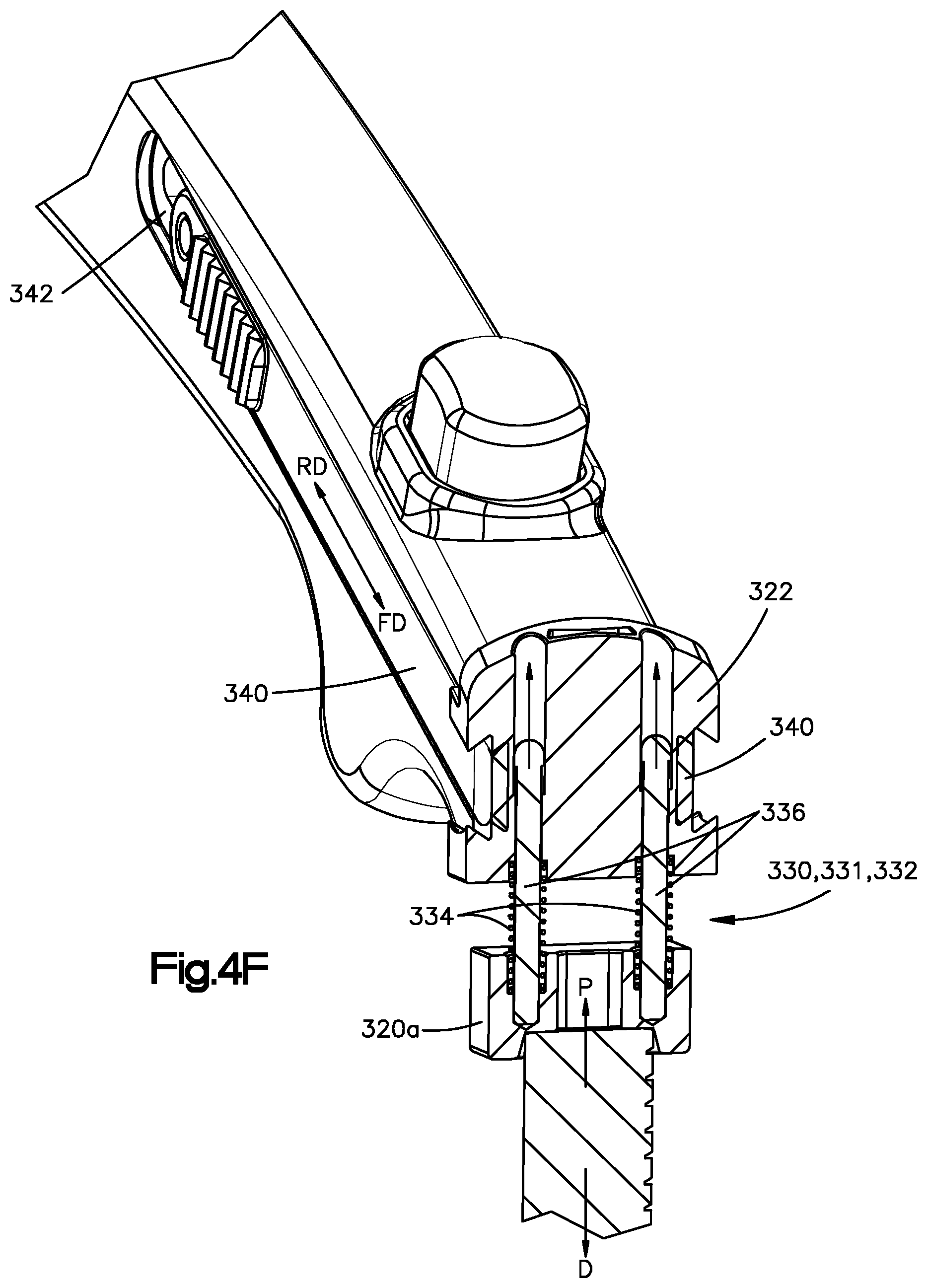 Patent US12496055 Figure 10 – Retractor members, and related systems and methods