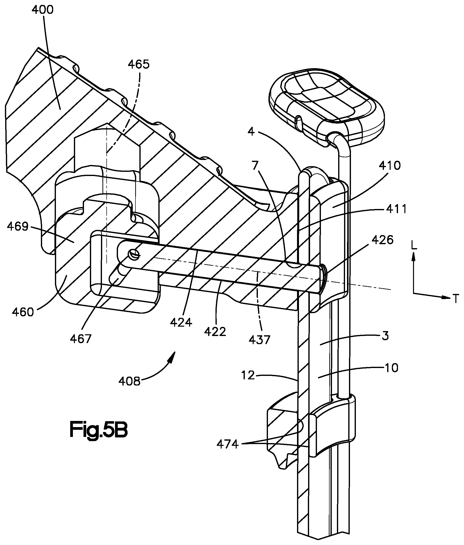 Patent US12496055 Figure 15 – Retractor members, and related systems and methods
