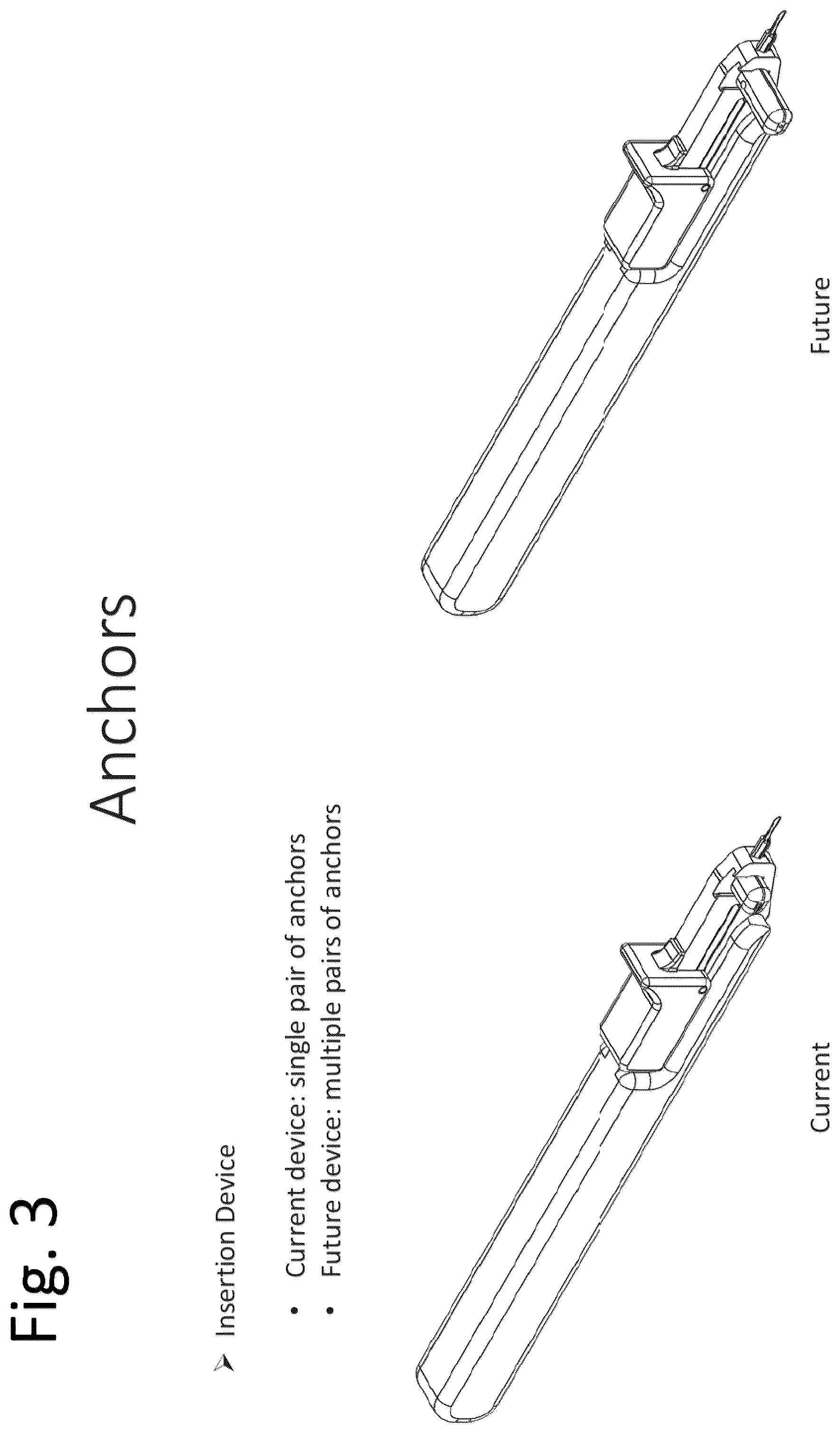 Patent US12496057 Figure 3 – Suture materials, suture placement devices and methods of suture placement and tissue approximation