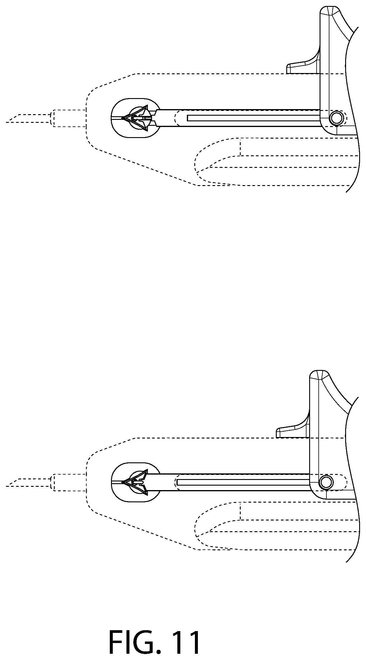 Patent US12496057 Figure 11 – Suture materials, suture placement devices and methods of suture placement and tissue approximation