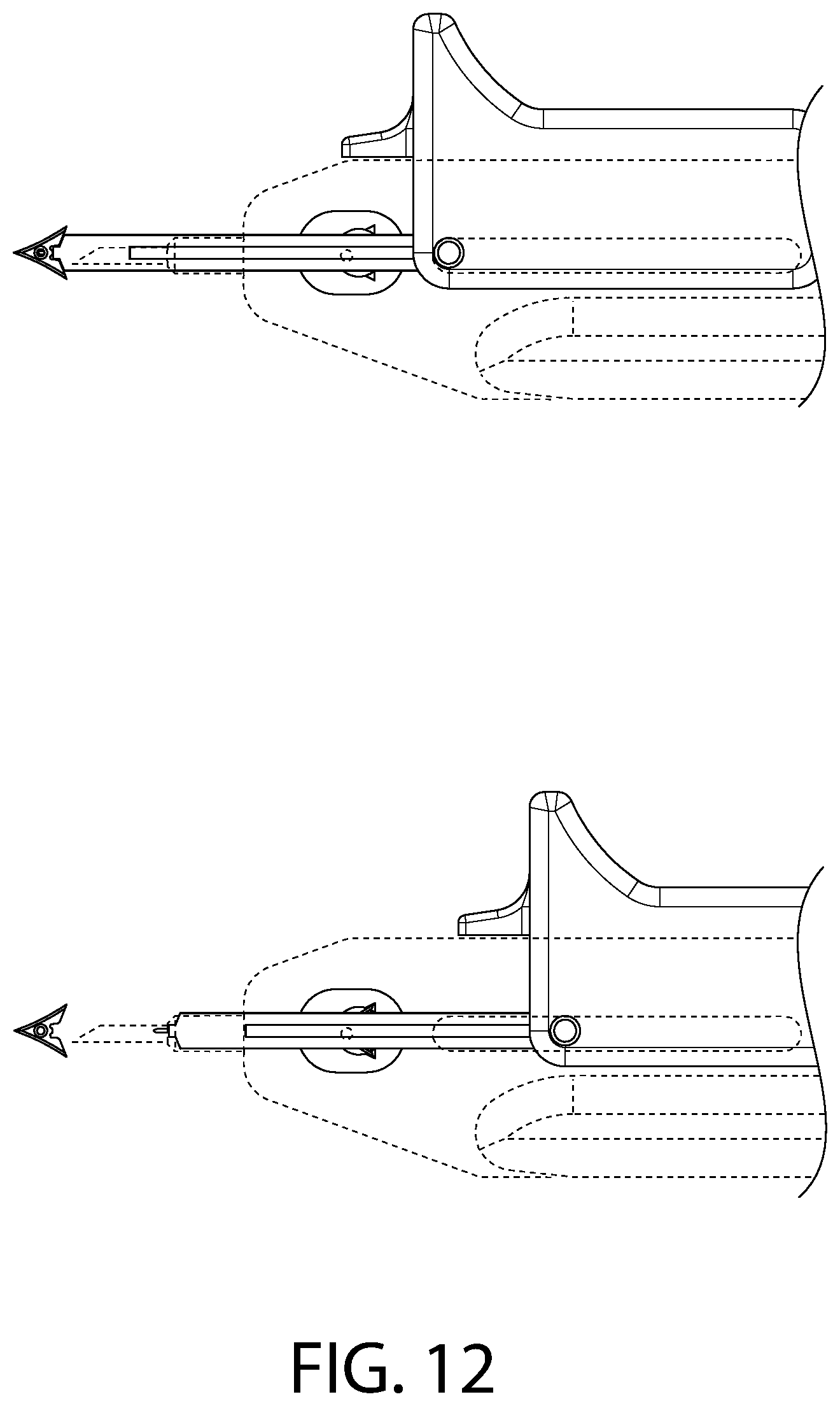 Patent US12496057 Figure 12 – Suture materials, suture placement devices and methods of suture placement and tissue approximation