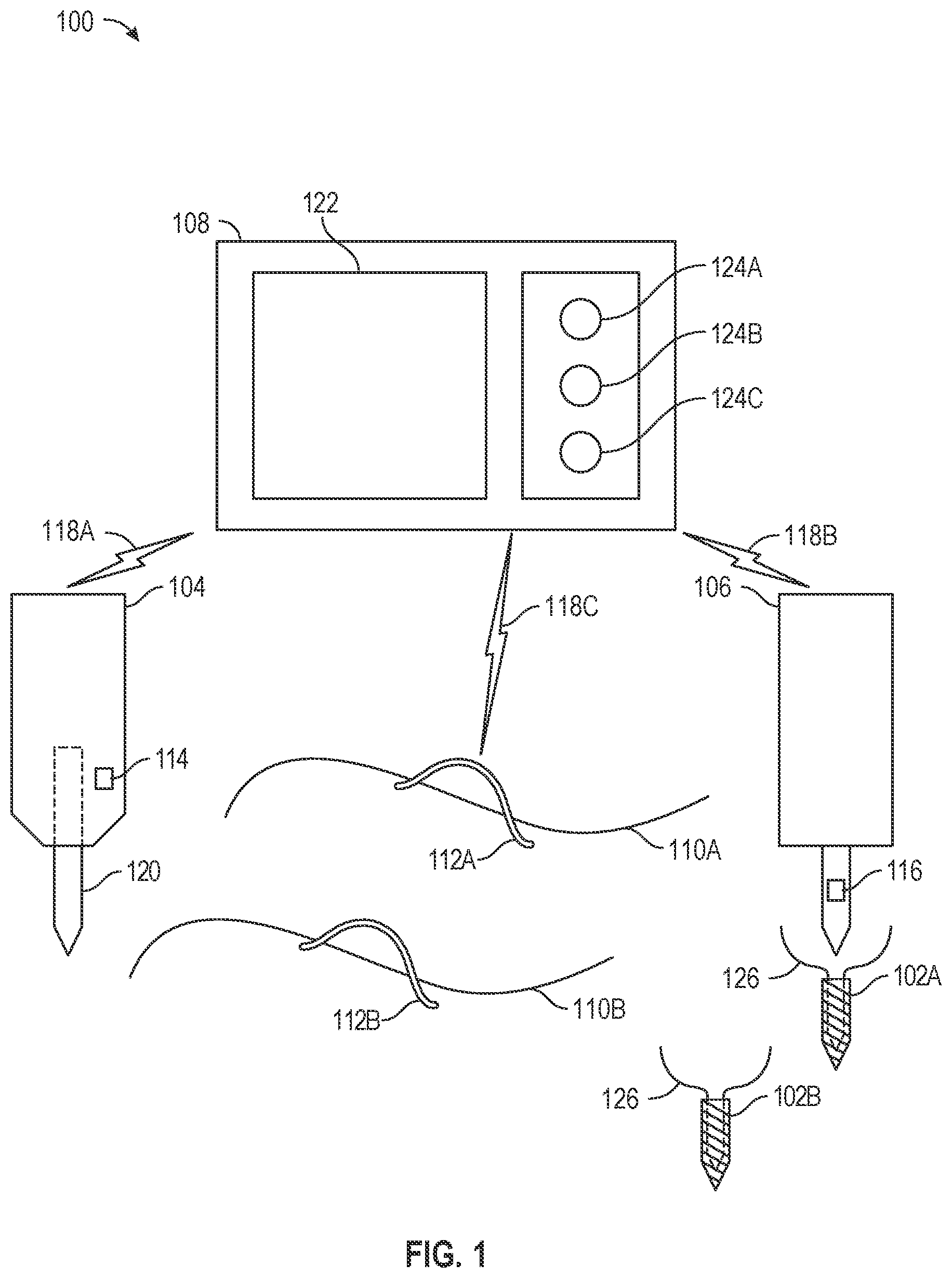 Patent US12496058 Figure 1 – Sensor-based arthroscopic anchor system