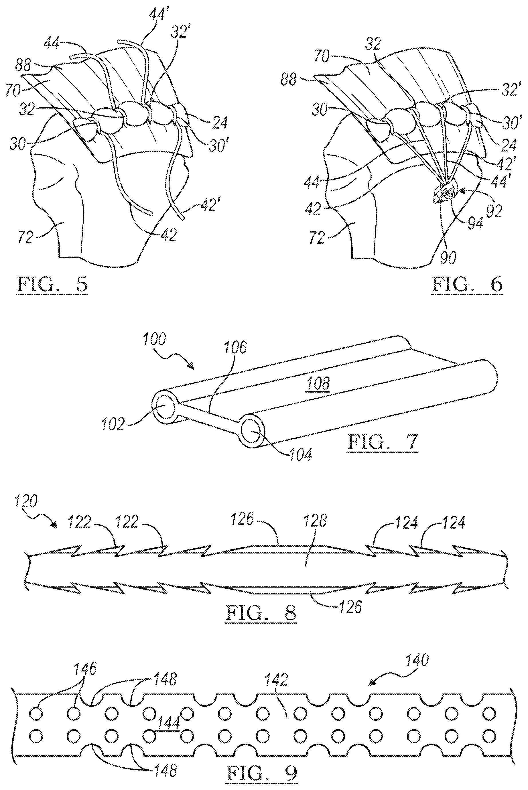 Patent US12496059 Figure 2 – Method and apparatus for soft tissue fixation