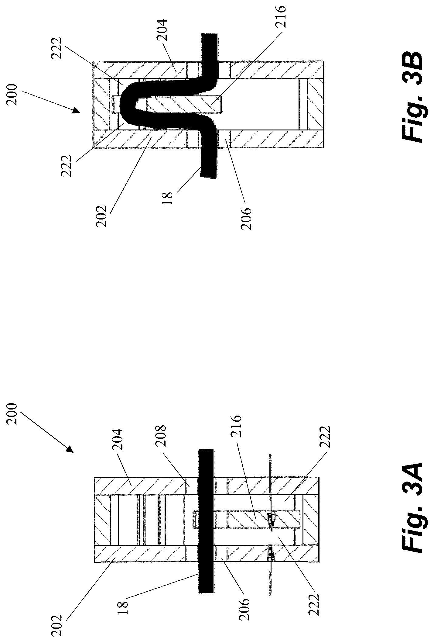 Patent US12496061 Figure 4 – Minimally invasive heart valve repair in a beating heart