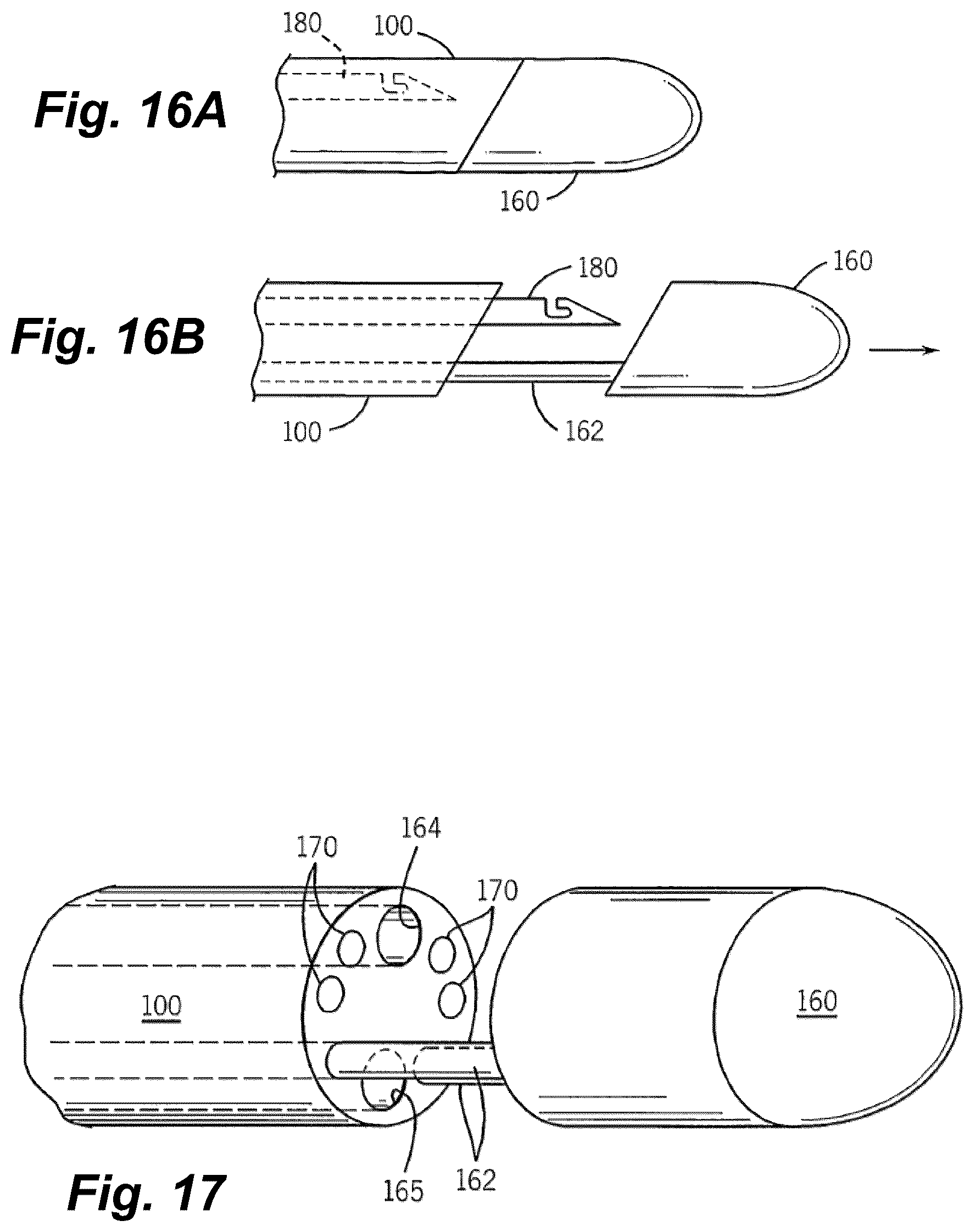Patent US12496061 Figure 15 – Minimally invasive heart valve repair in a beating heart
