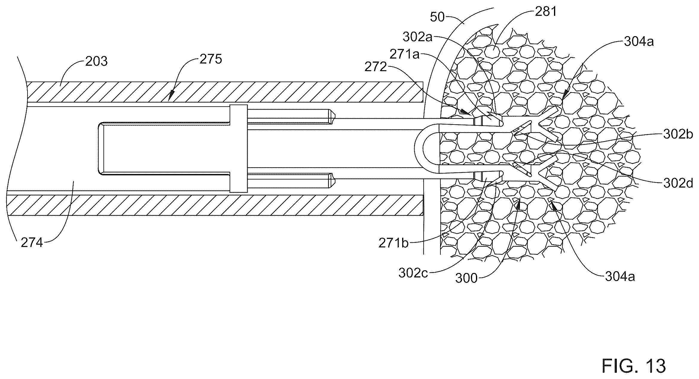 Patent US12496062 Figure 12 – Bone anchor delivery system