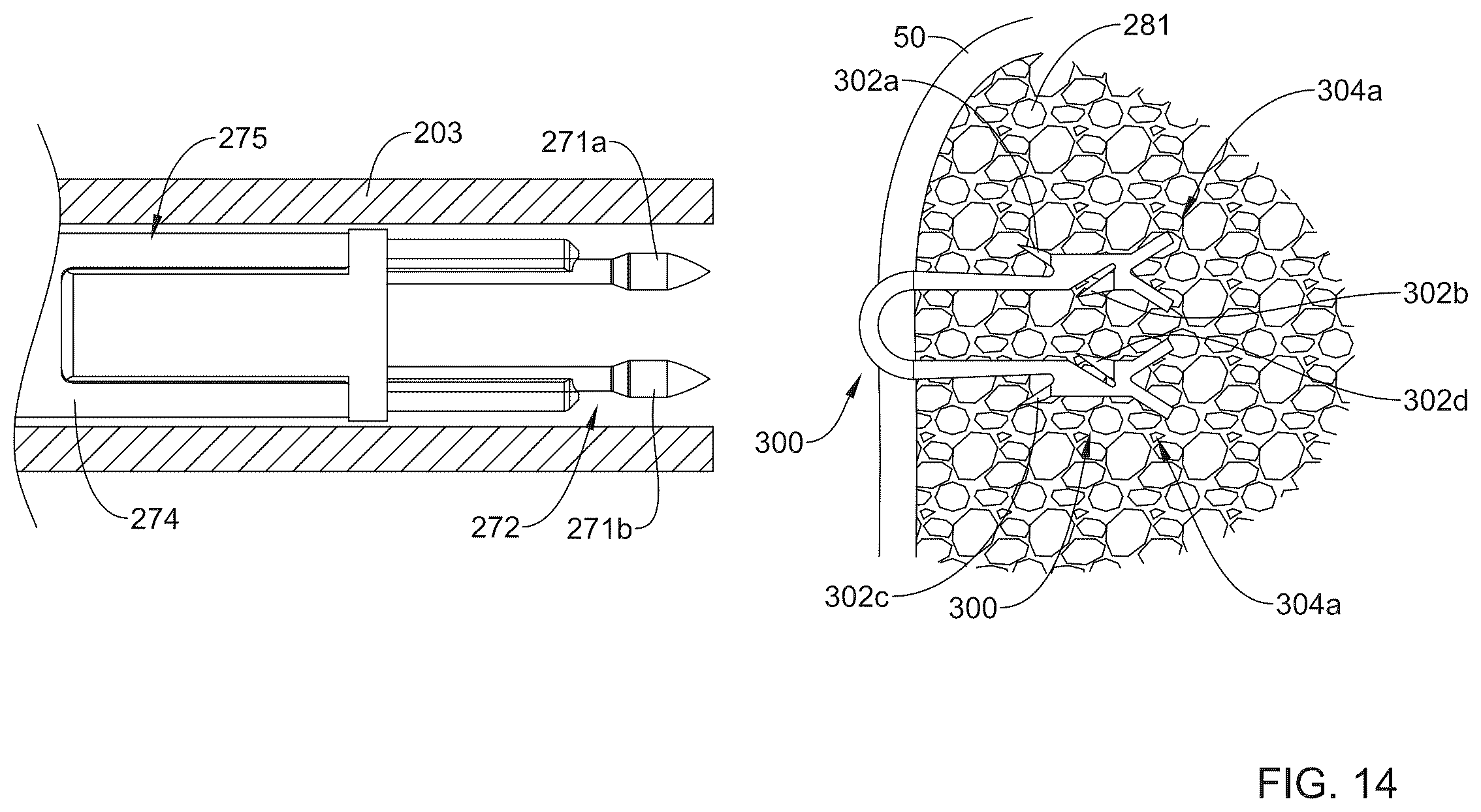 Patent US12496062 Figure 13 – Bone anchor delivery system