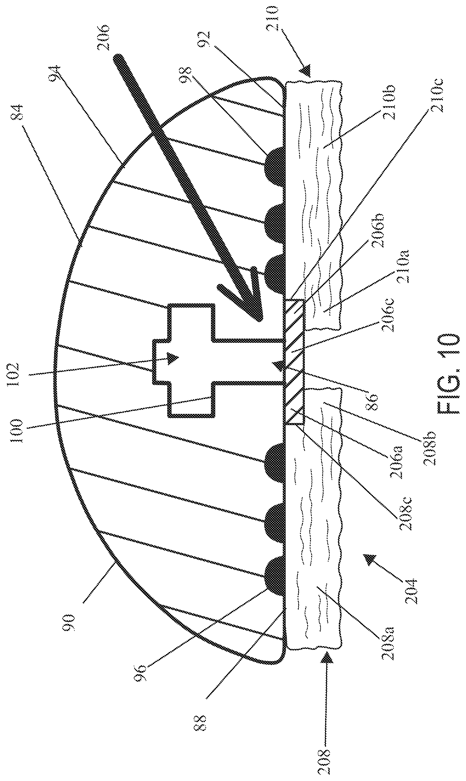 Patent US12496067 Figure 8 – Implantable adjunct with density gradients