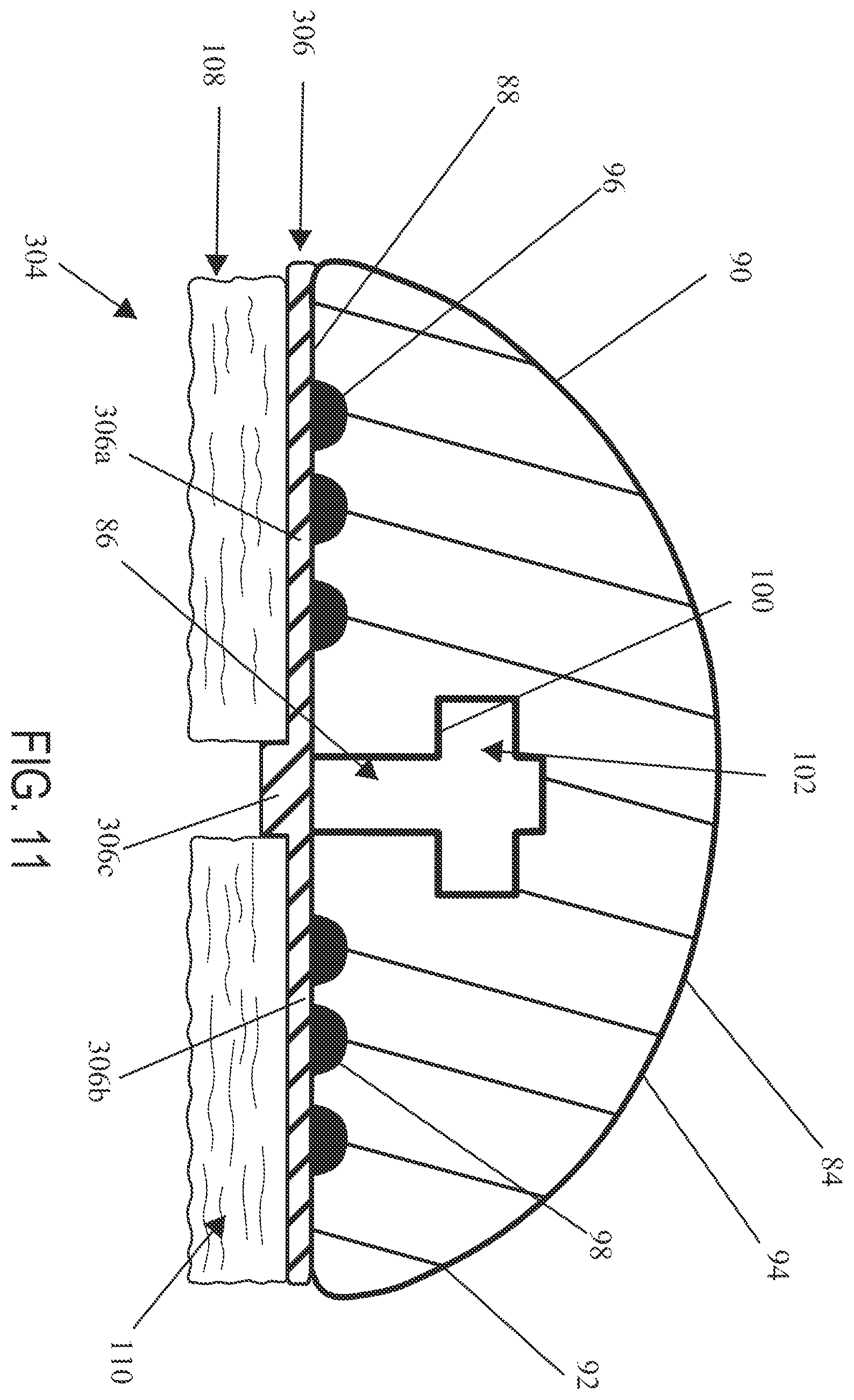 Patent US12496067 Figure 9 – Implantable adjunct with density gradients