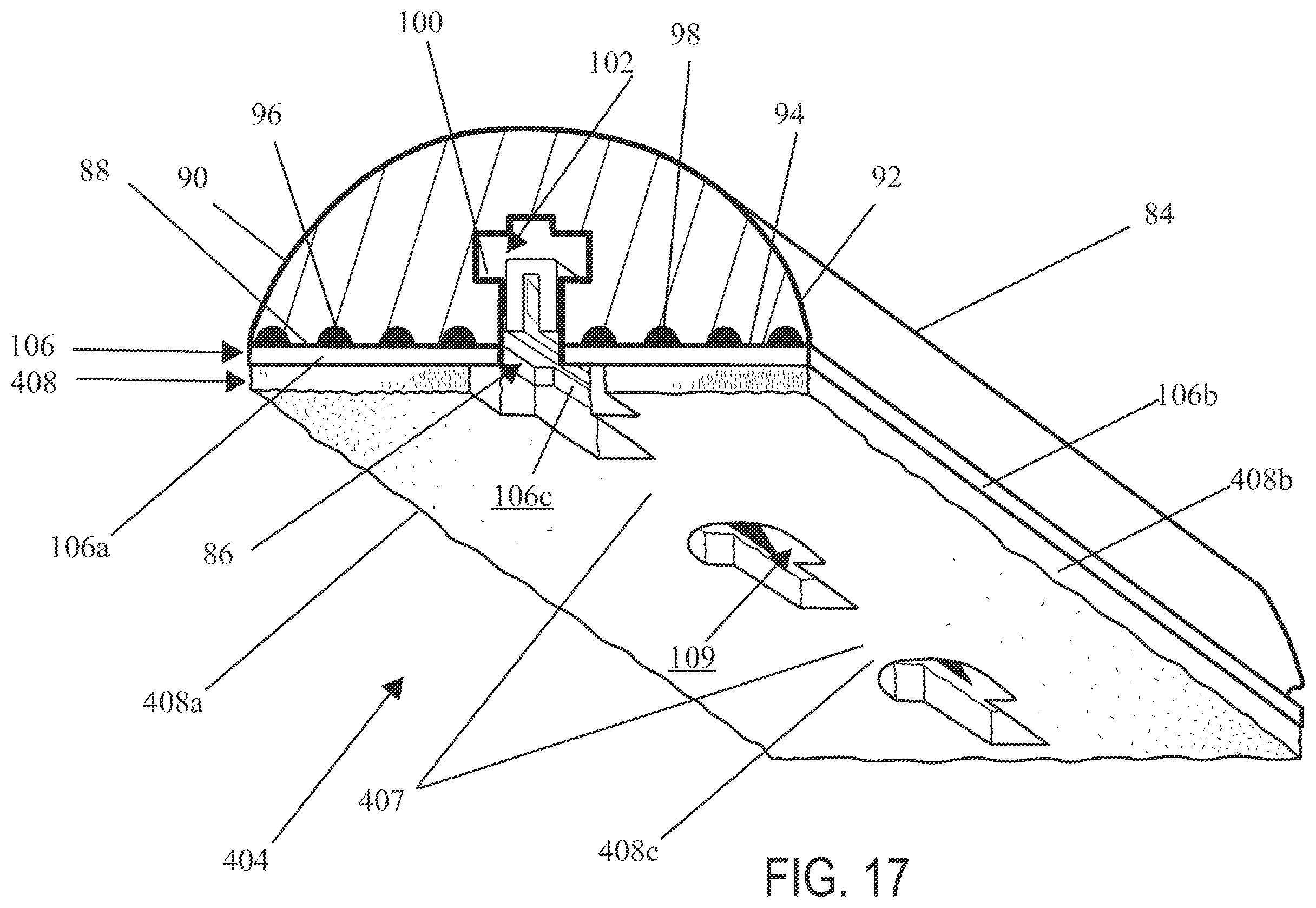 Patent US12496067 Figure 15 – Implantable adjunct with density gradients